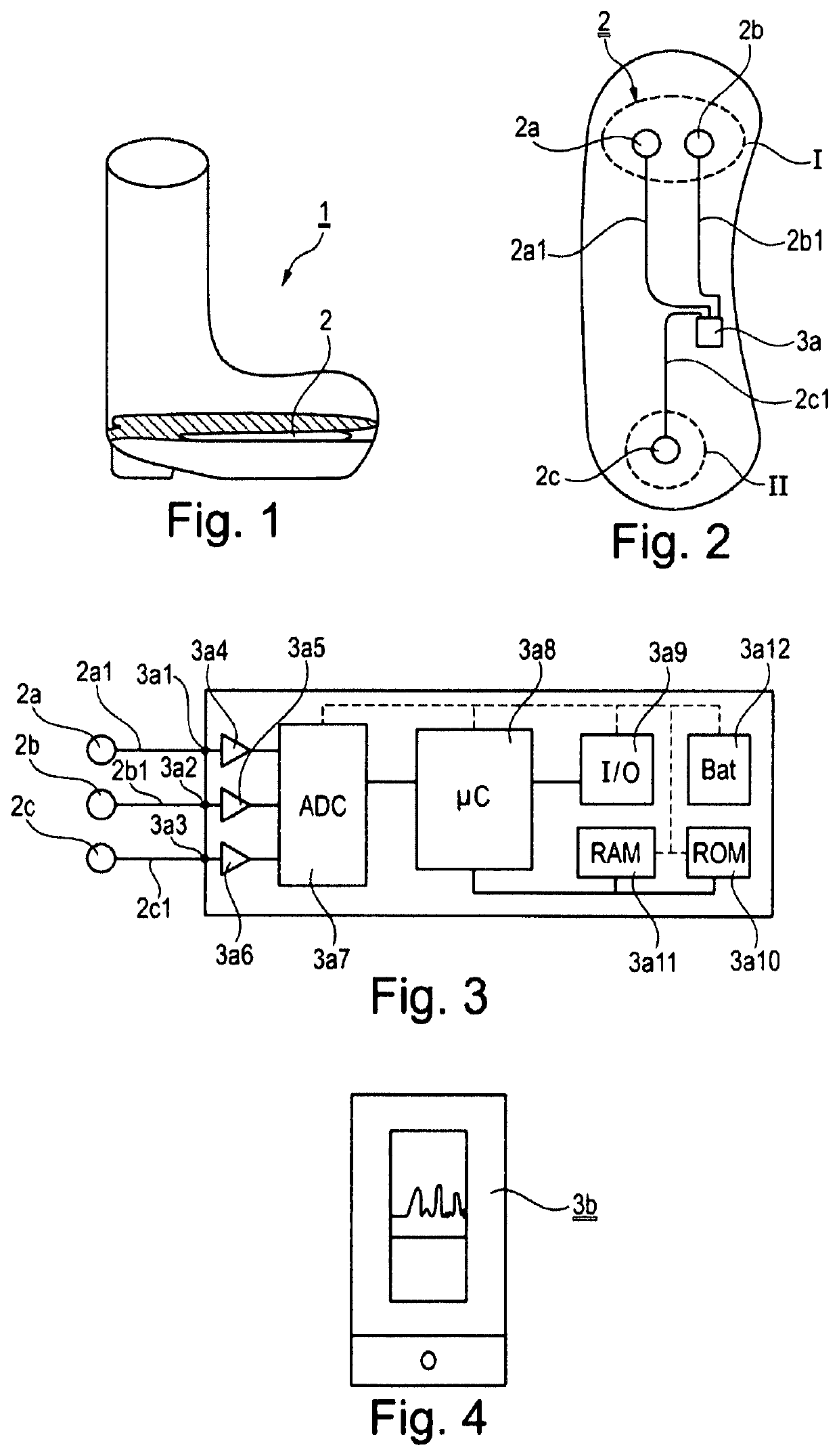 Load-detecting orthosis