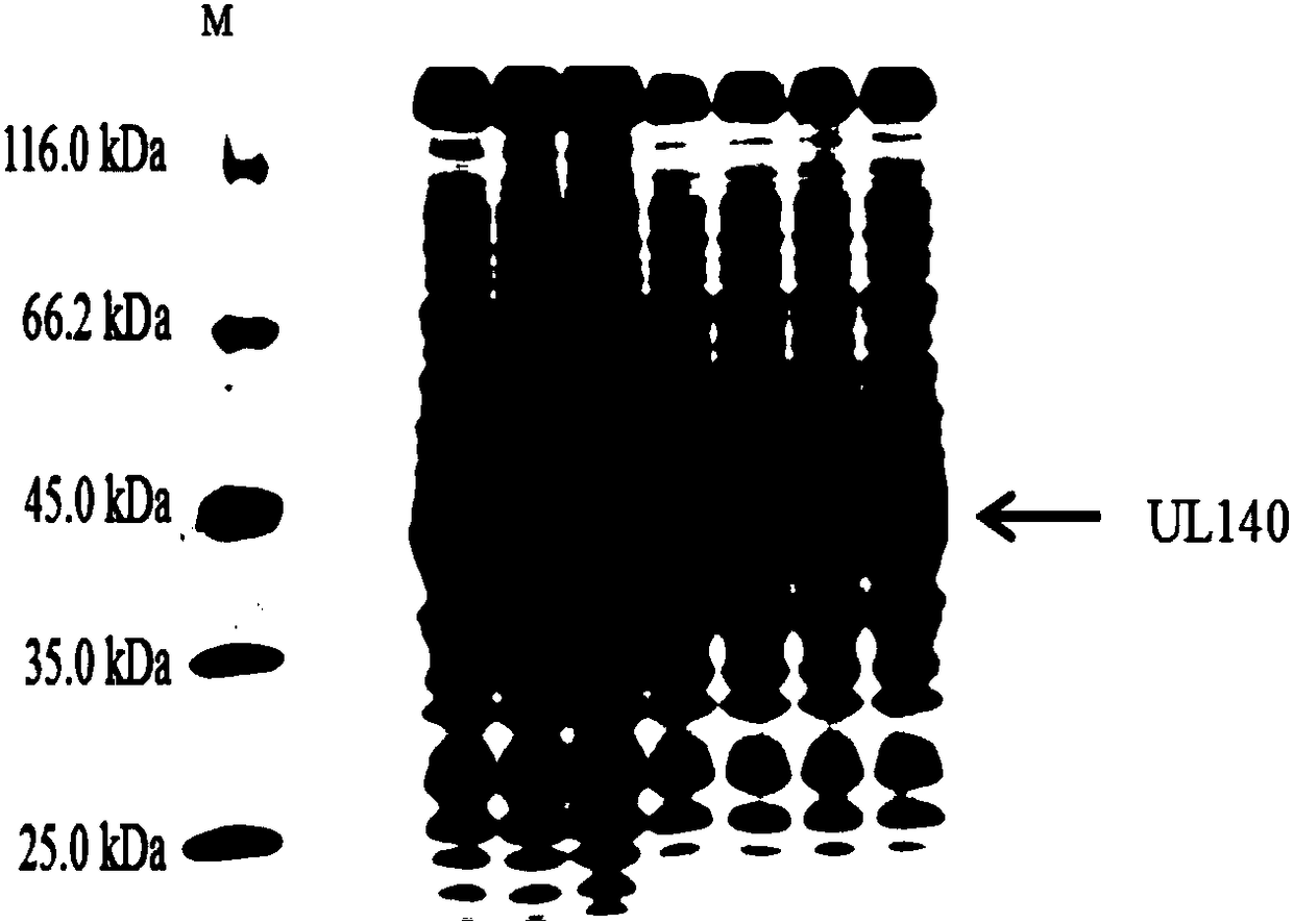 Recombinant plasmid with human cytomegalovirus UL140 gene and genetic engineering bacterium and application thereof