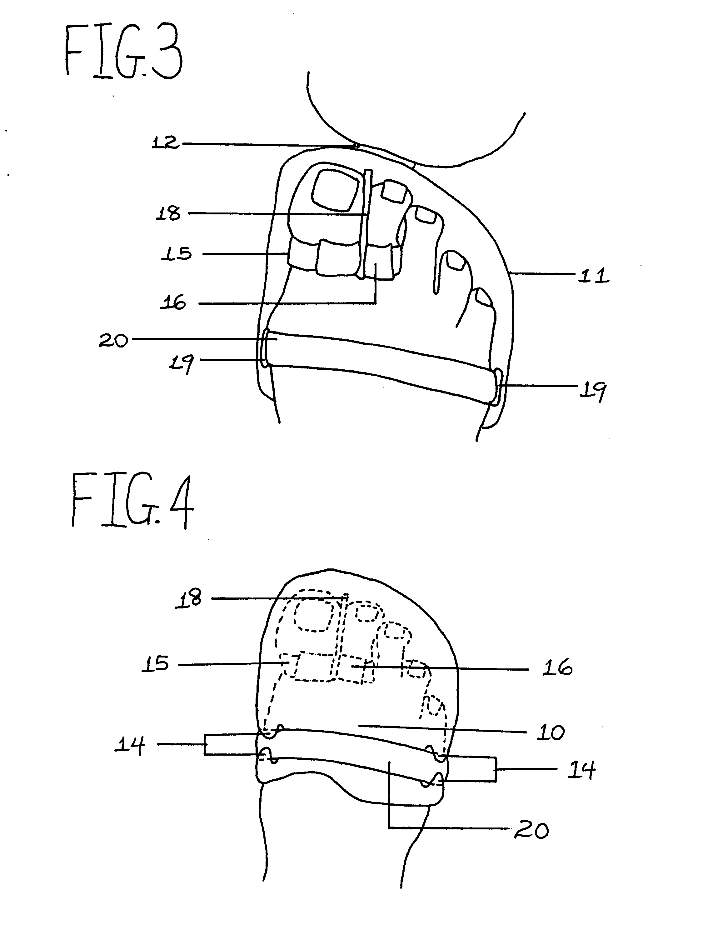 Wearable pedicure protection device