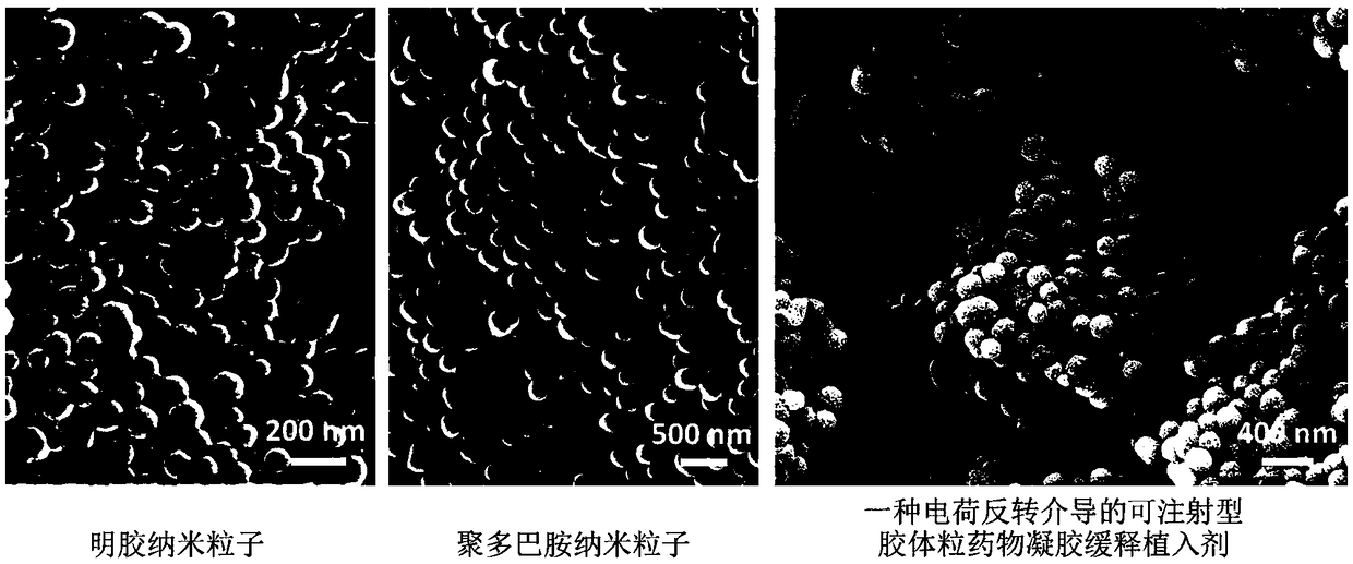 Charge reversal-mediated injectable colloid grain drug gel slow-release implant and preparation method thereof