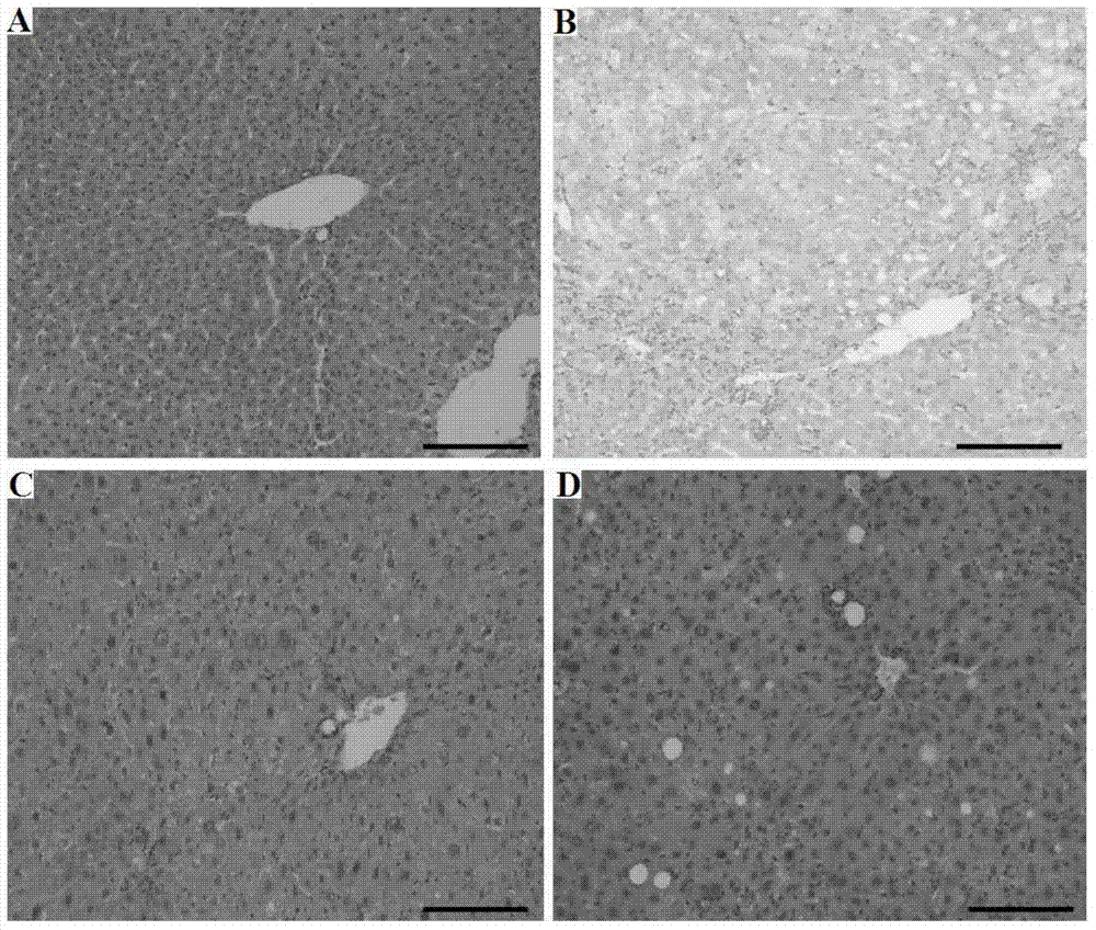 Application of gynura procumbens extracts to preparation of liver injury prevention and cure preparations