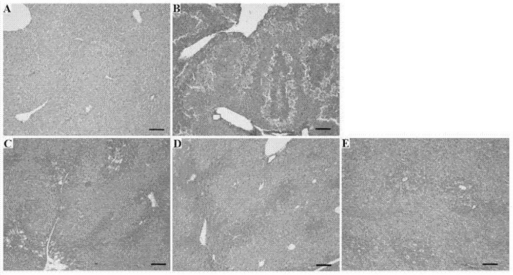 Application of gynura procumbens extracts to preparation of liver injury prevention and cure preparations