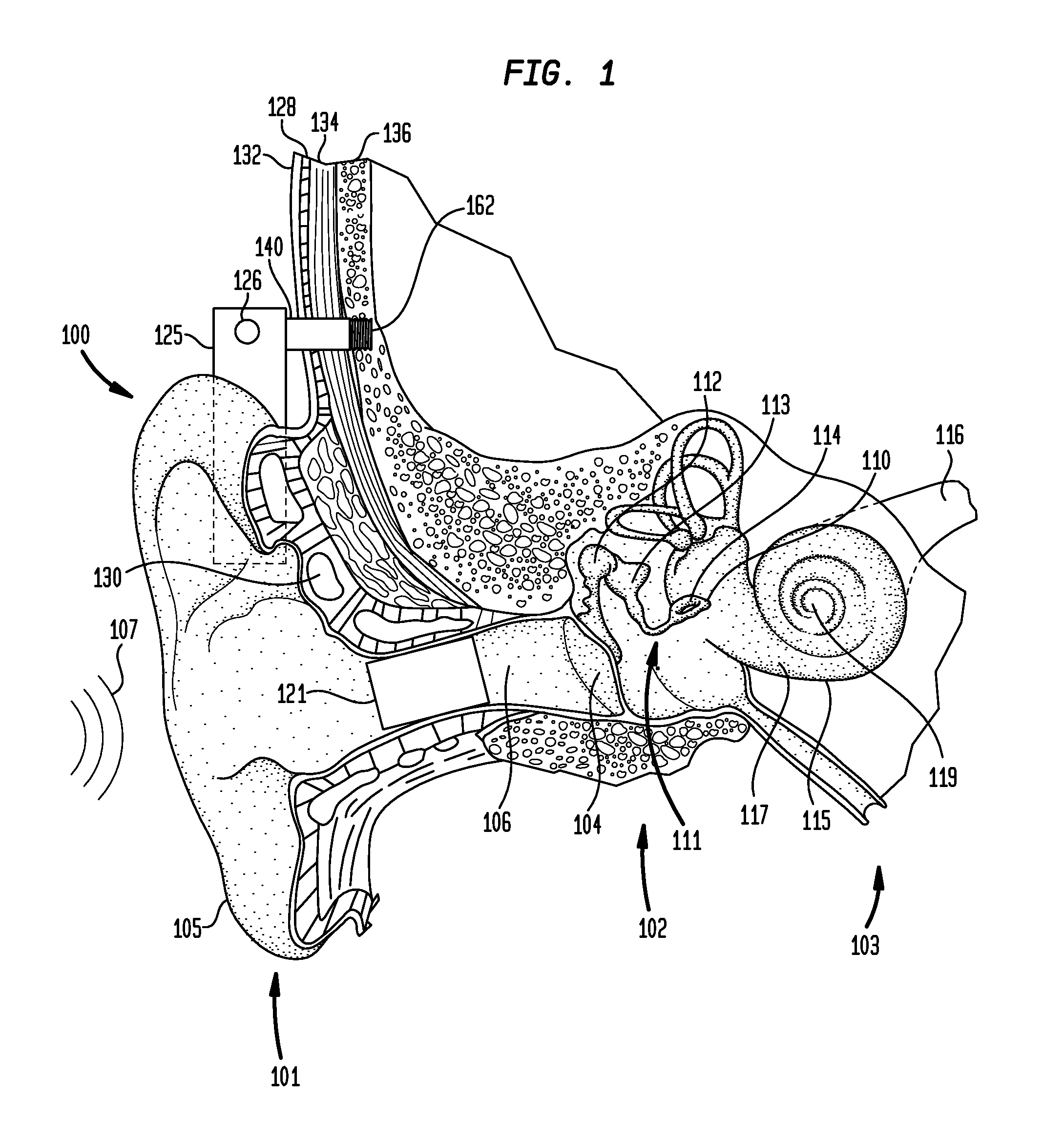 Multi-mode hearing prosthesis