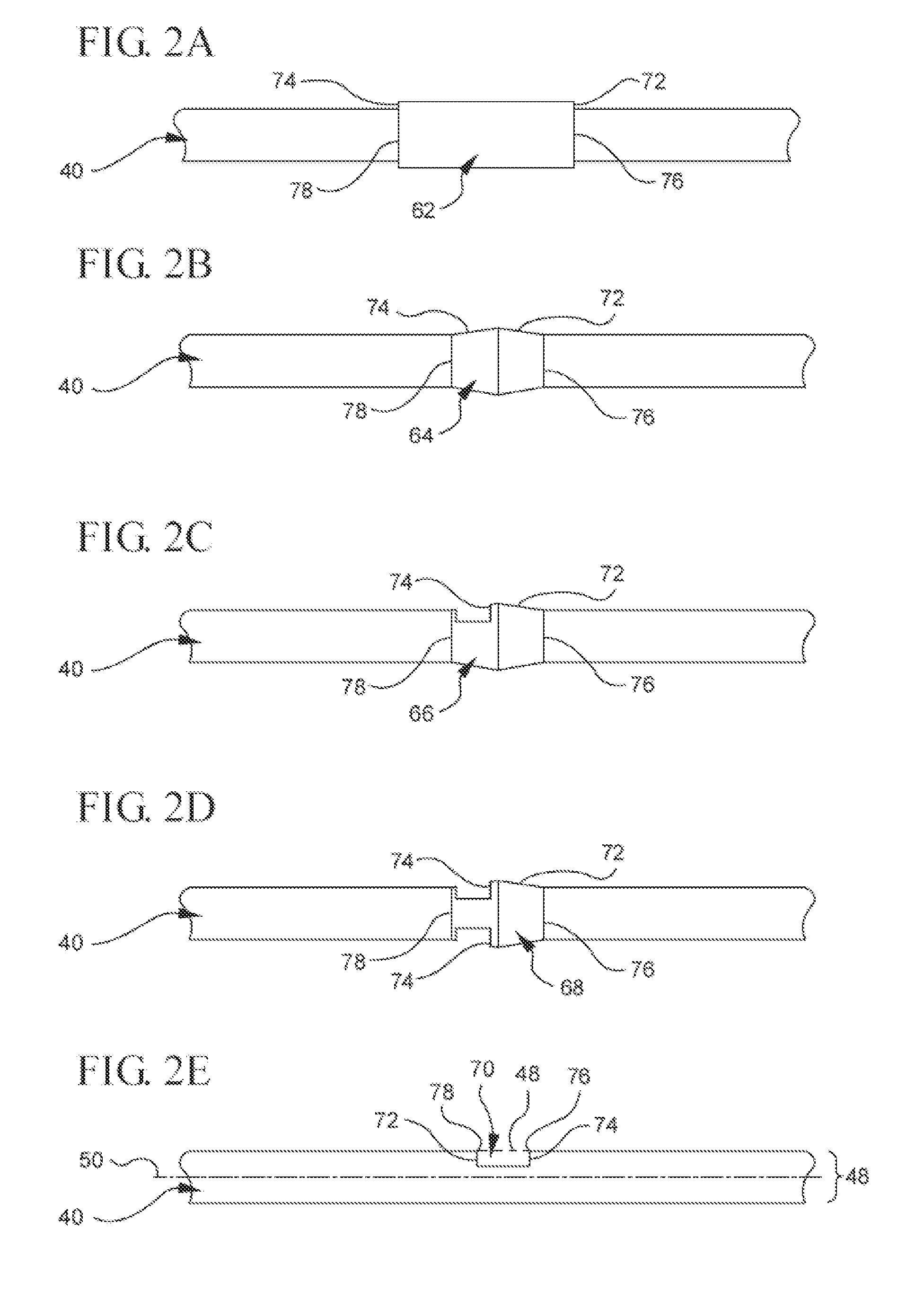 Bi-directional cannula feature capture mechanism