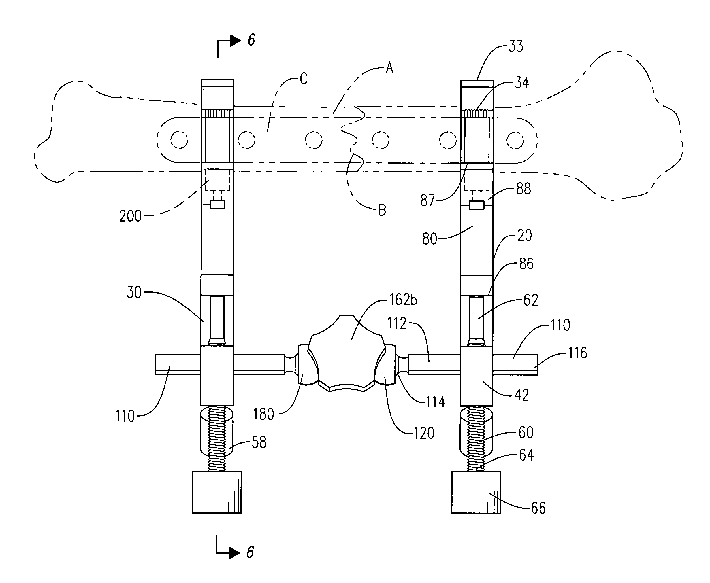 Bone reduction and plate clamp assembly