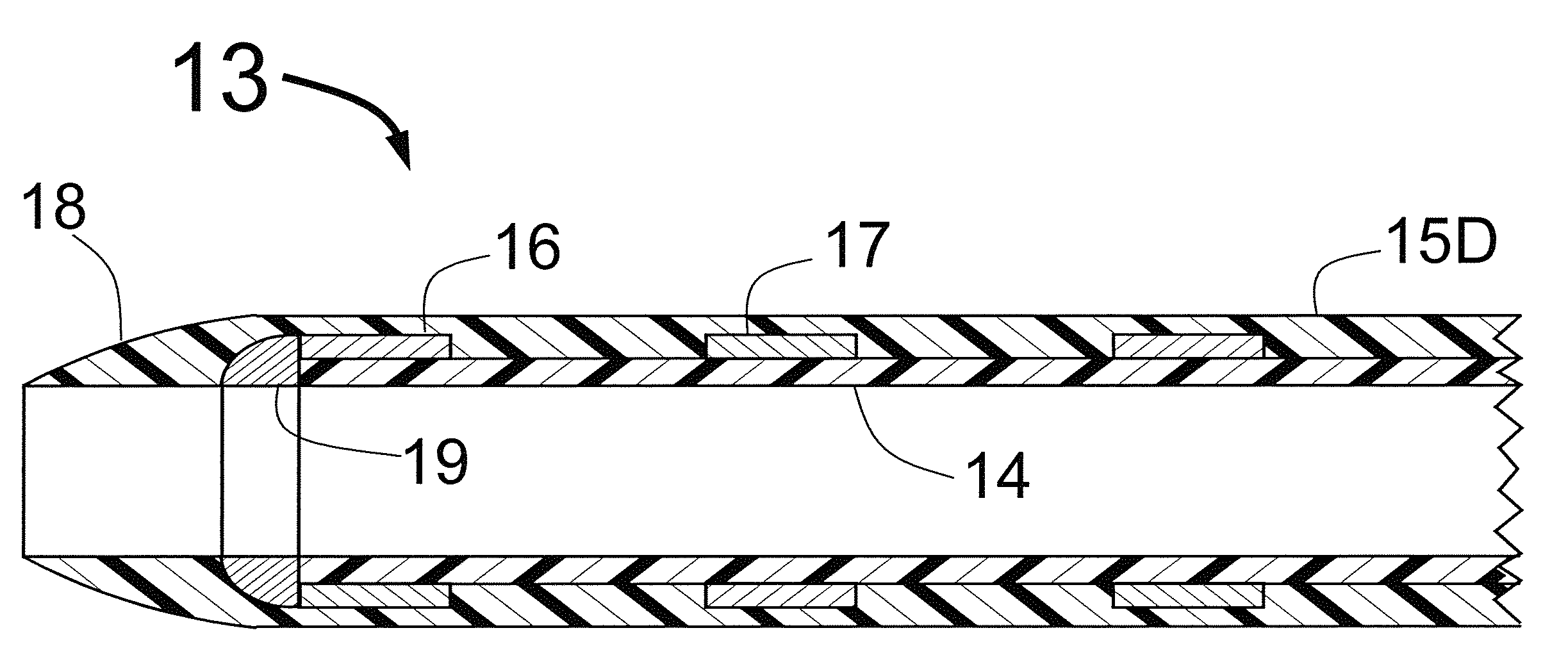 Carotid sheath with flexible distal section