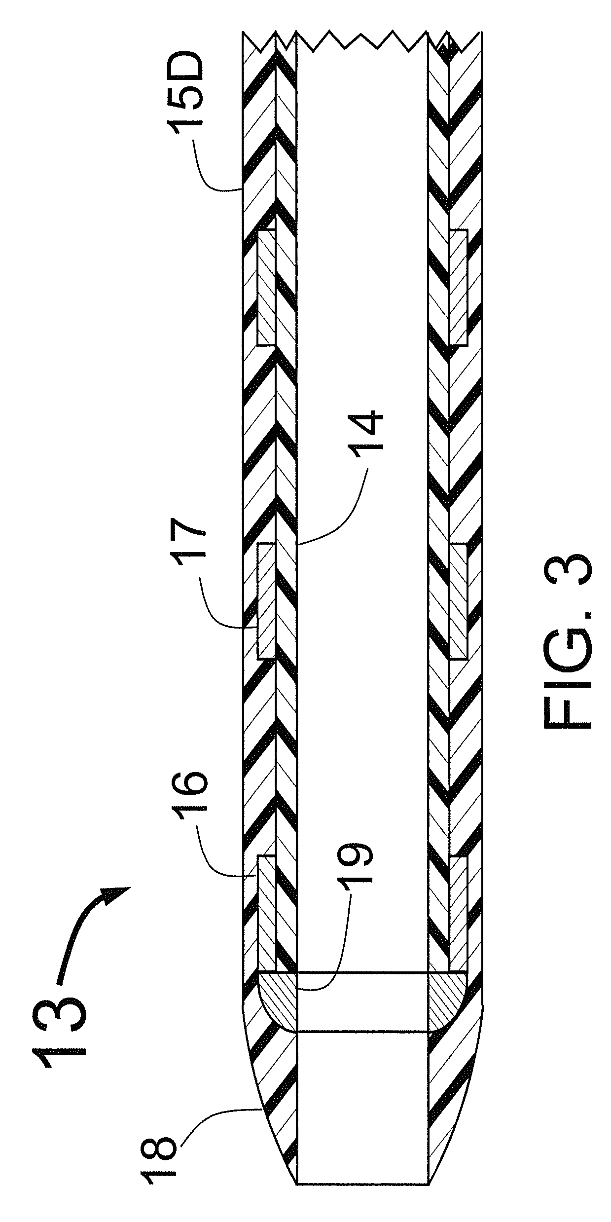 Carotid sheath with flexible distal section