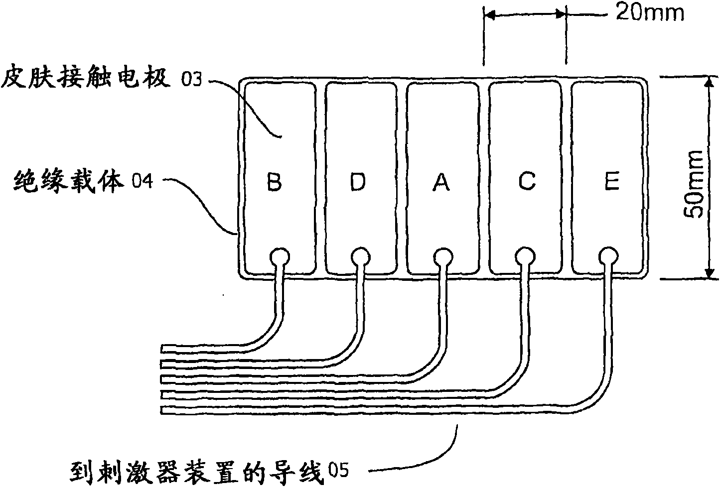 Array stimulator