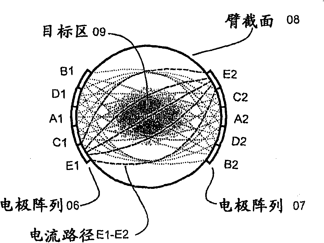 Array stimulator