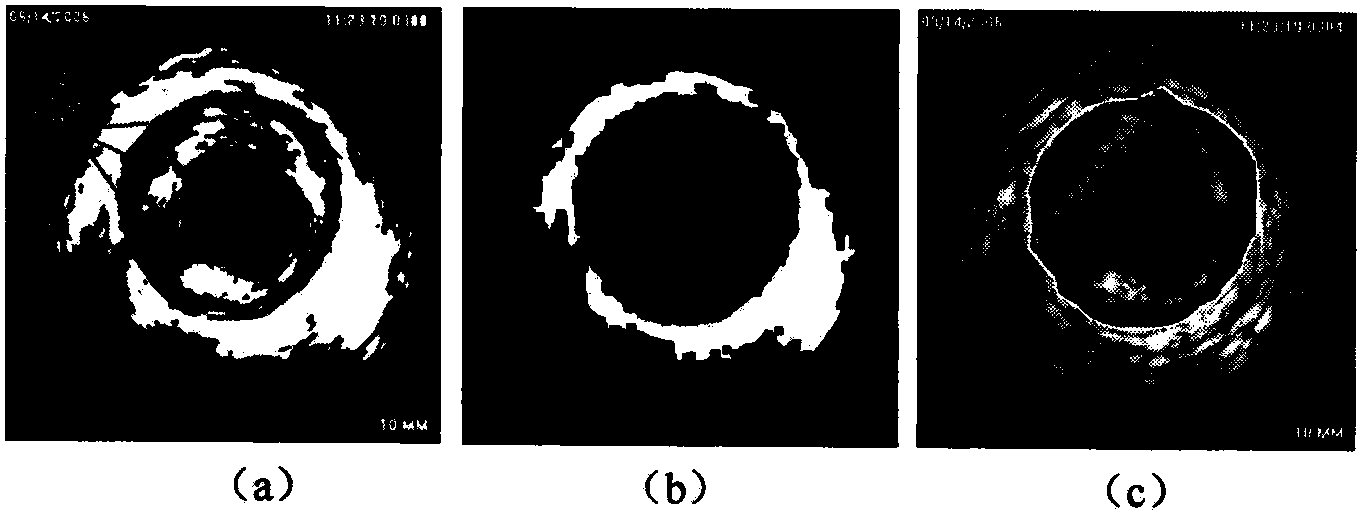 Automatic vessel wall edge detection method based on intravascular ultrasound image sequence