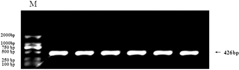 Detection method and detection kit for goat LMCD1 gene mononucleotide polymorphism sites