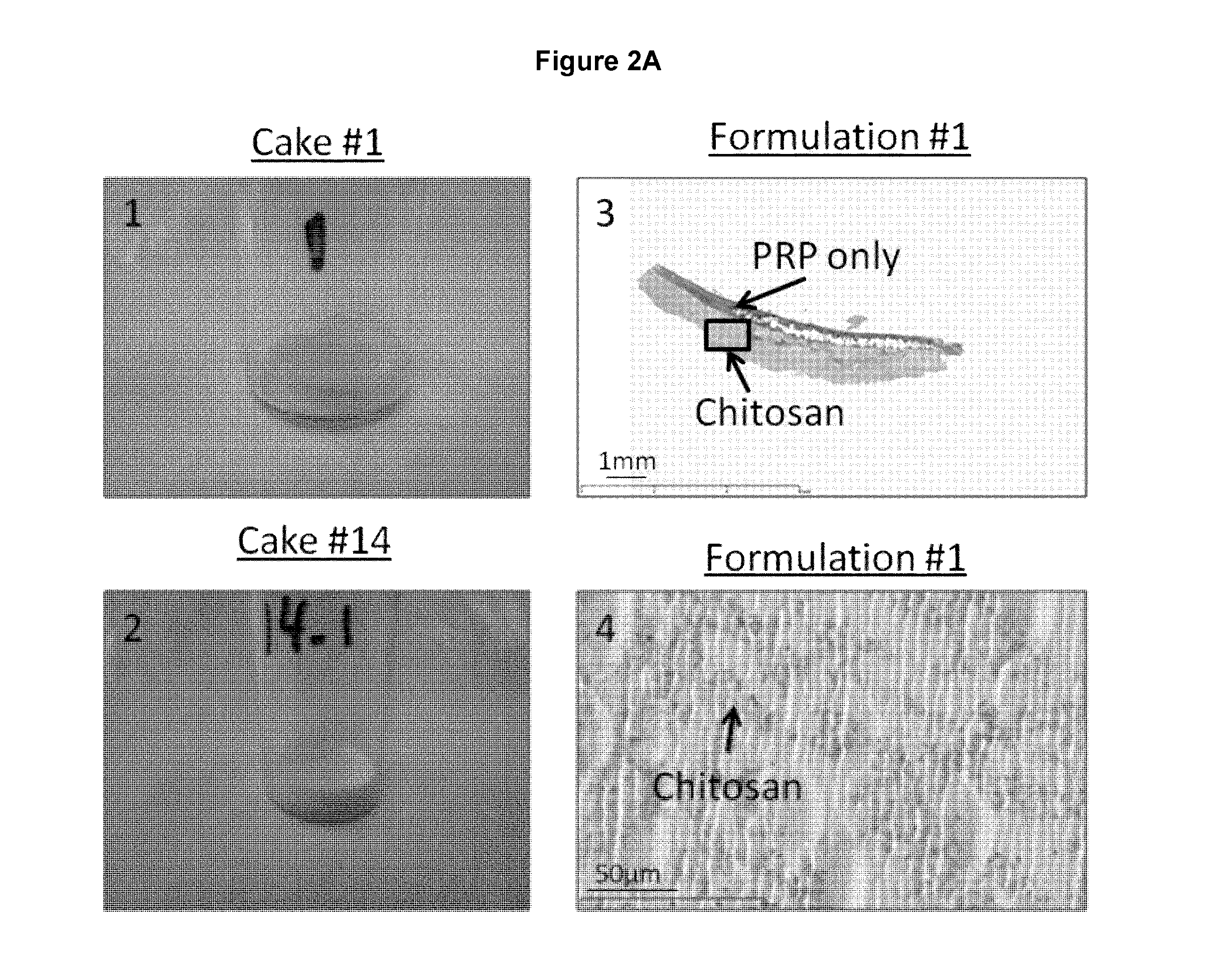 Freeze-dried polymer compositions for mixing with platelet rich plasma to form implants for tissue repair and/or compositions for therapeutic intra-articular injections