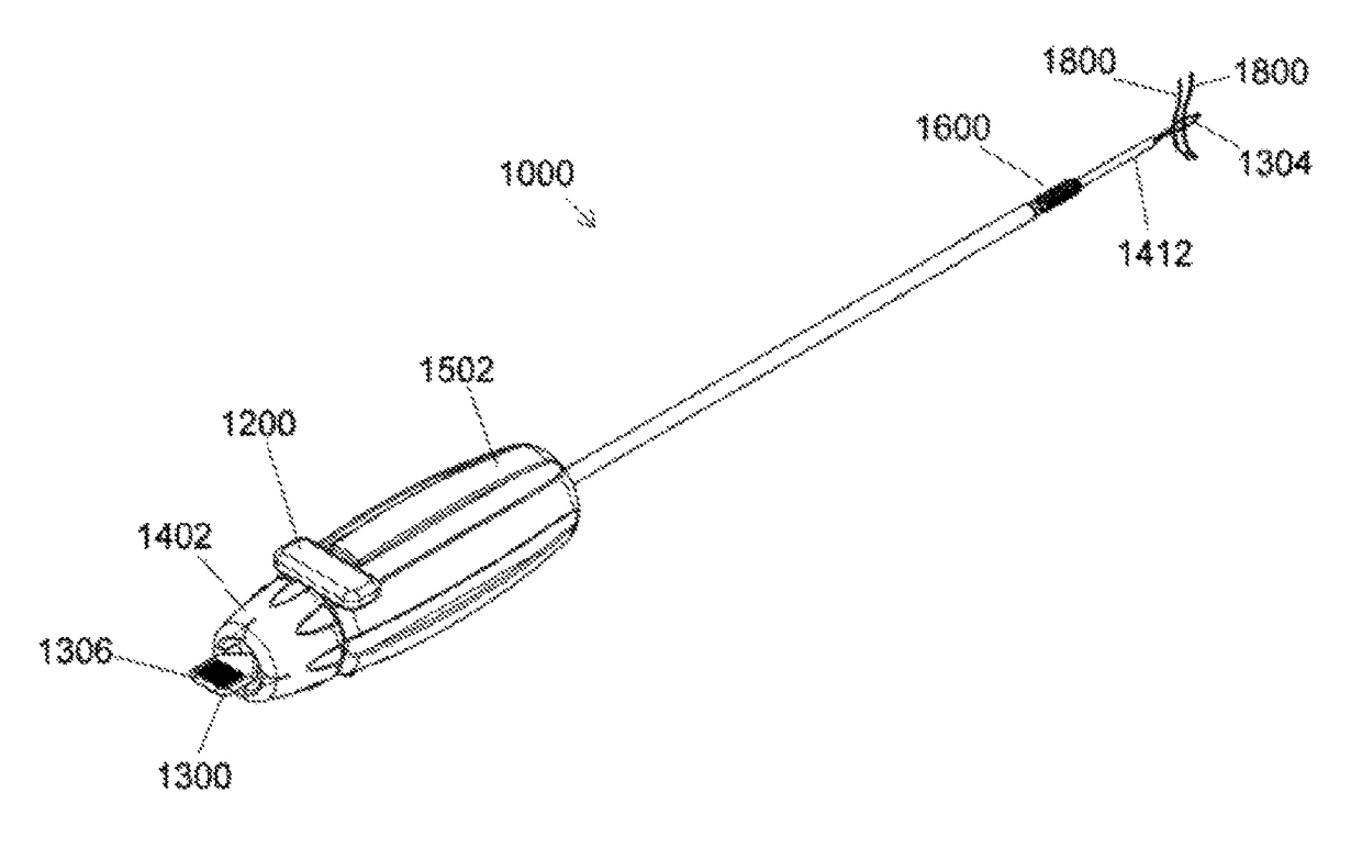 Ceramic implant placement systems and superelastic suture retention loops for use therewith