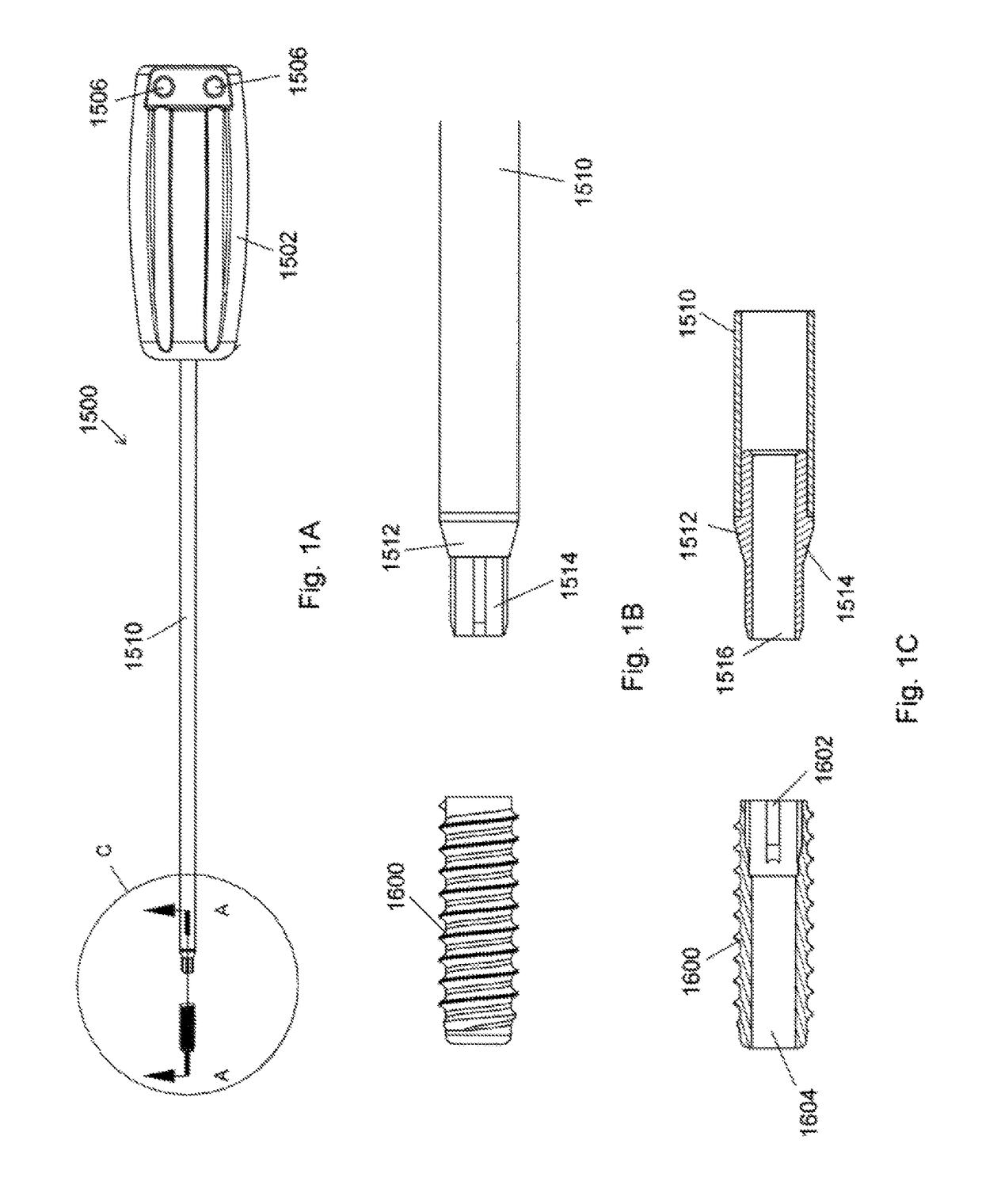 Ceramic implant placement systems and superelastic suture retention loops for use therewith