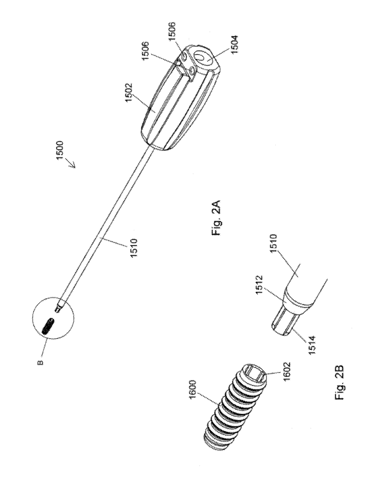 Ceramic implant placement systems and superelastic suture retention loops for use therewith