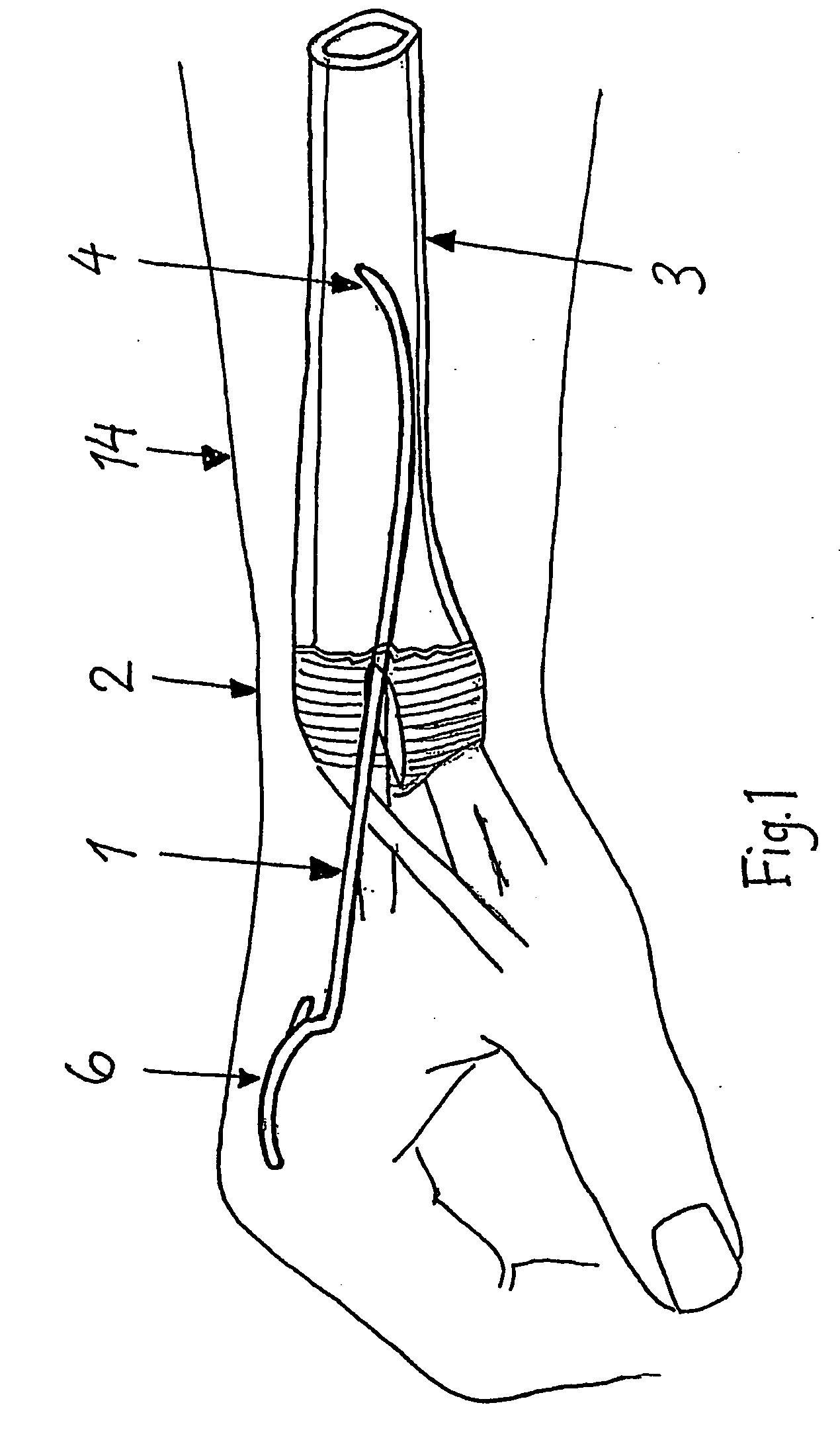 Surgical Fixation Pin