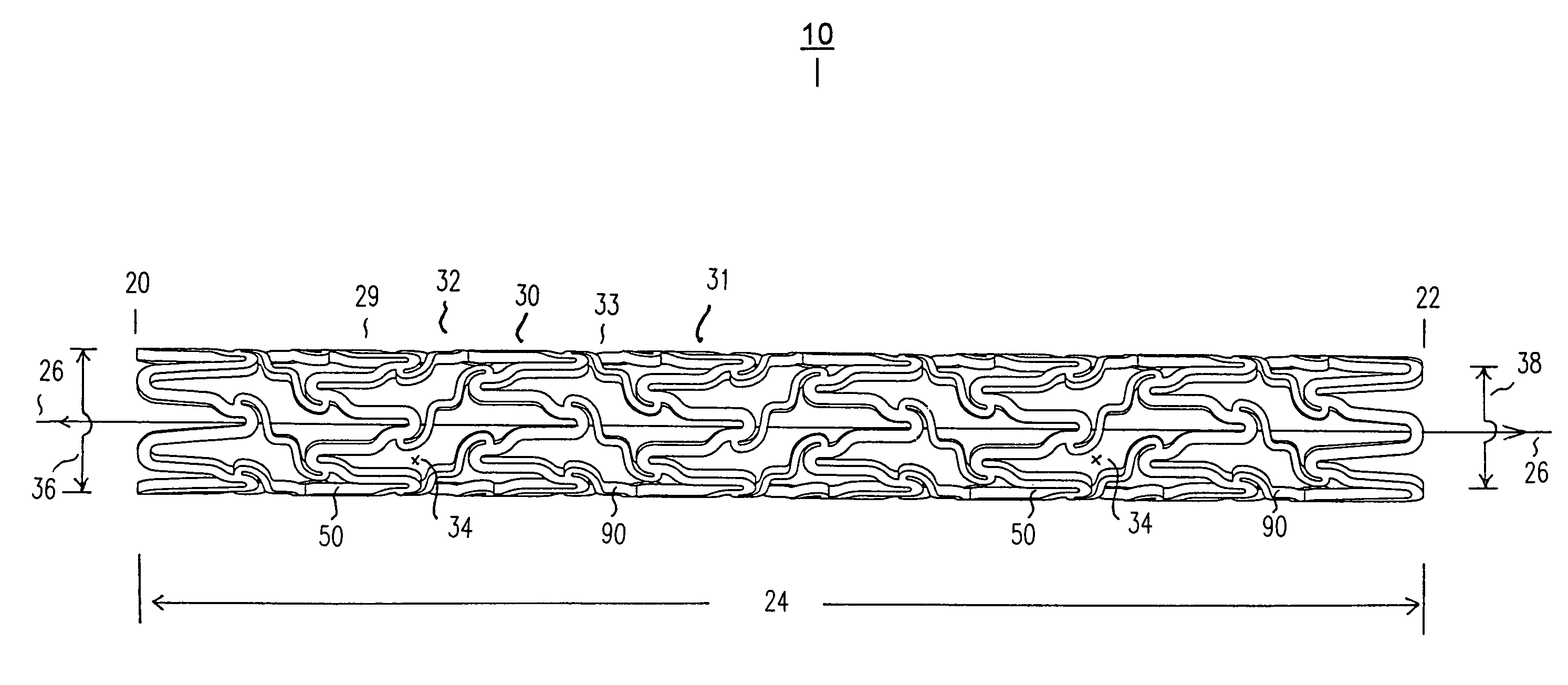 Intravascular stent and assembly