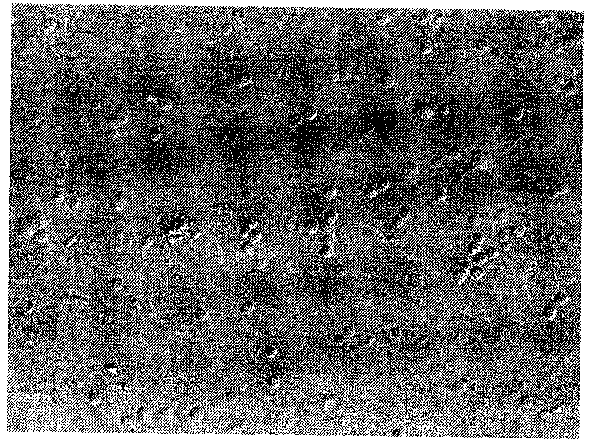 Method for stimulating rapid proliferation of CIK (Cytokine-induced Killer) cells by using DC (Dendritic Cells)