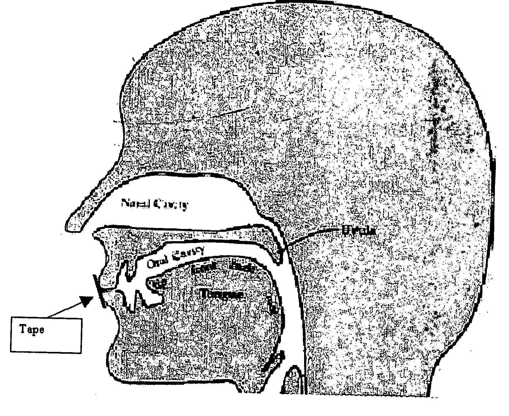 Device to reduce snoring, drooling, and talking while sleeping