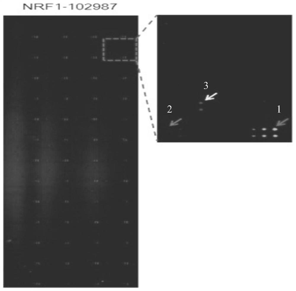 Tuberculosis protein interacting with human protein nrf1 and its application