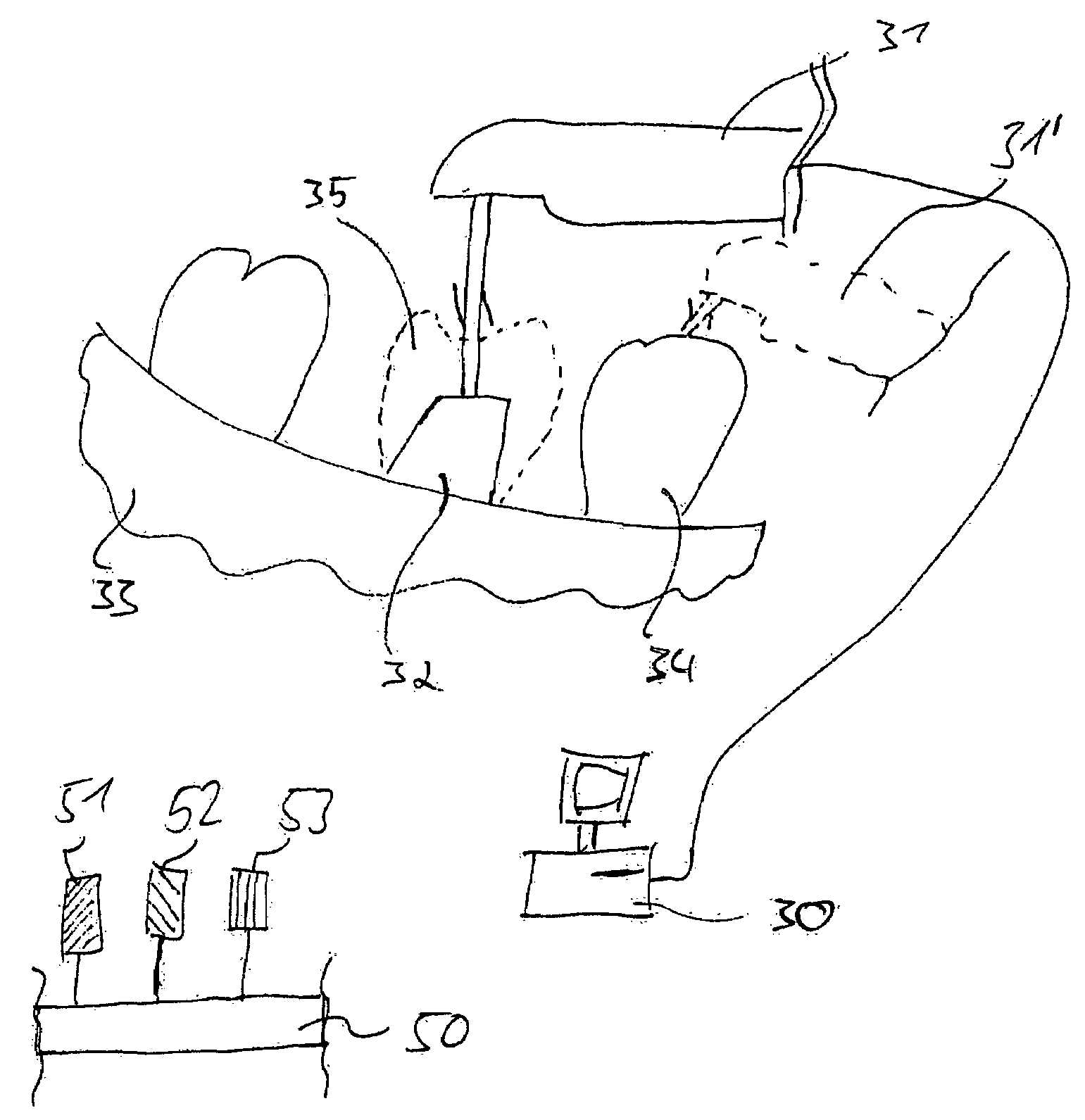 Method and apparatus for selecting non-opacious dental materials