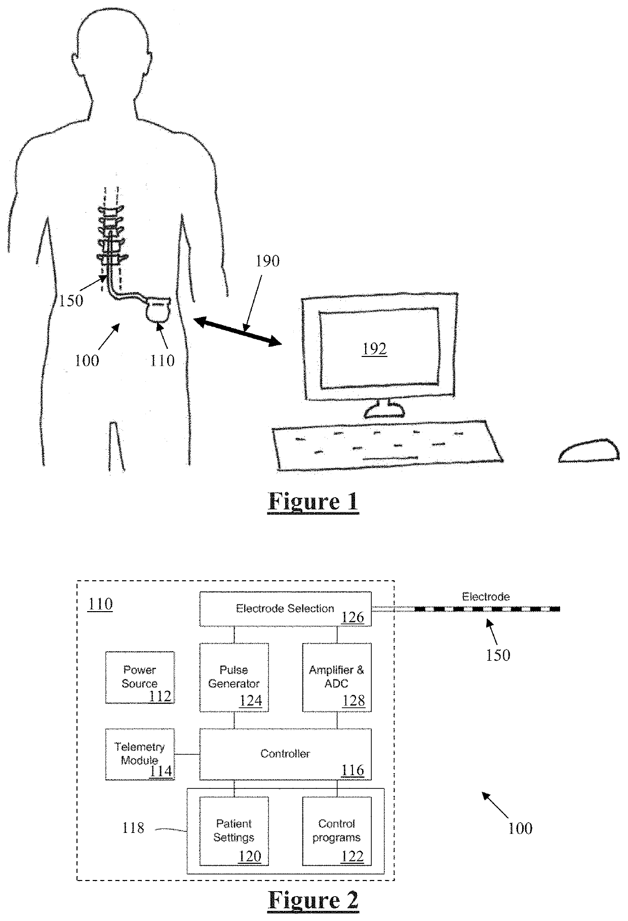 Electrode to Nerve Distance Estimation