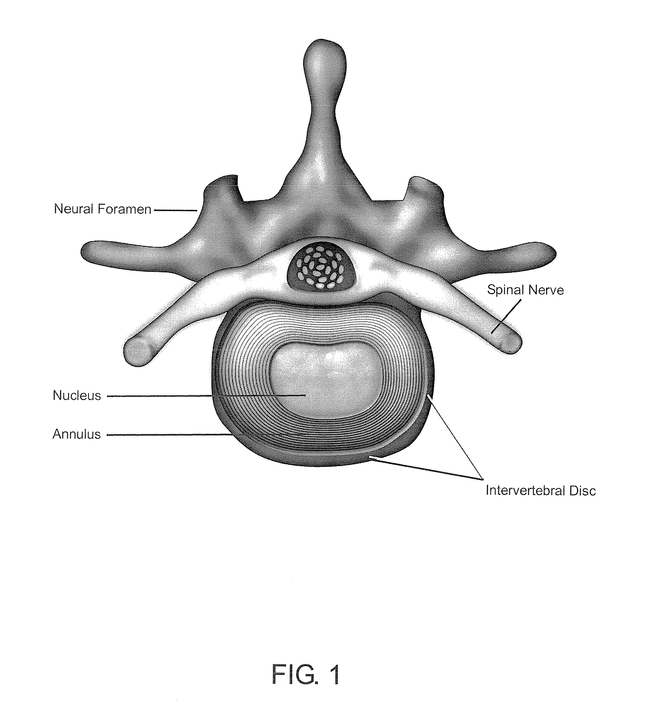 Methods and compositions for repair of cartilage using an in vivo bioreactor