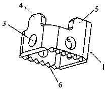 Tenon-and-mortise type artificial vertebrae