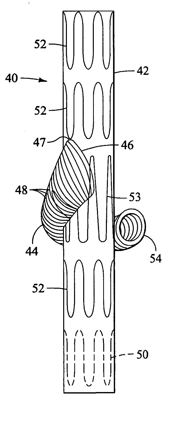 Branched vessel endoluminal device