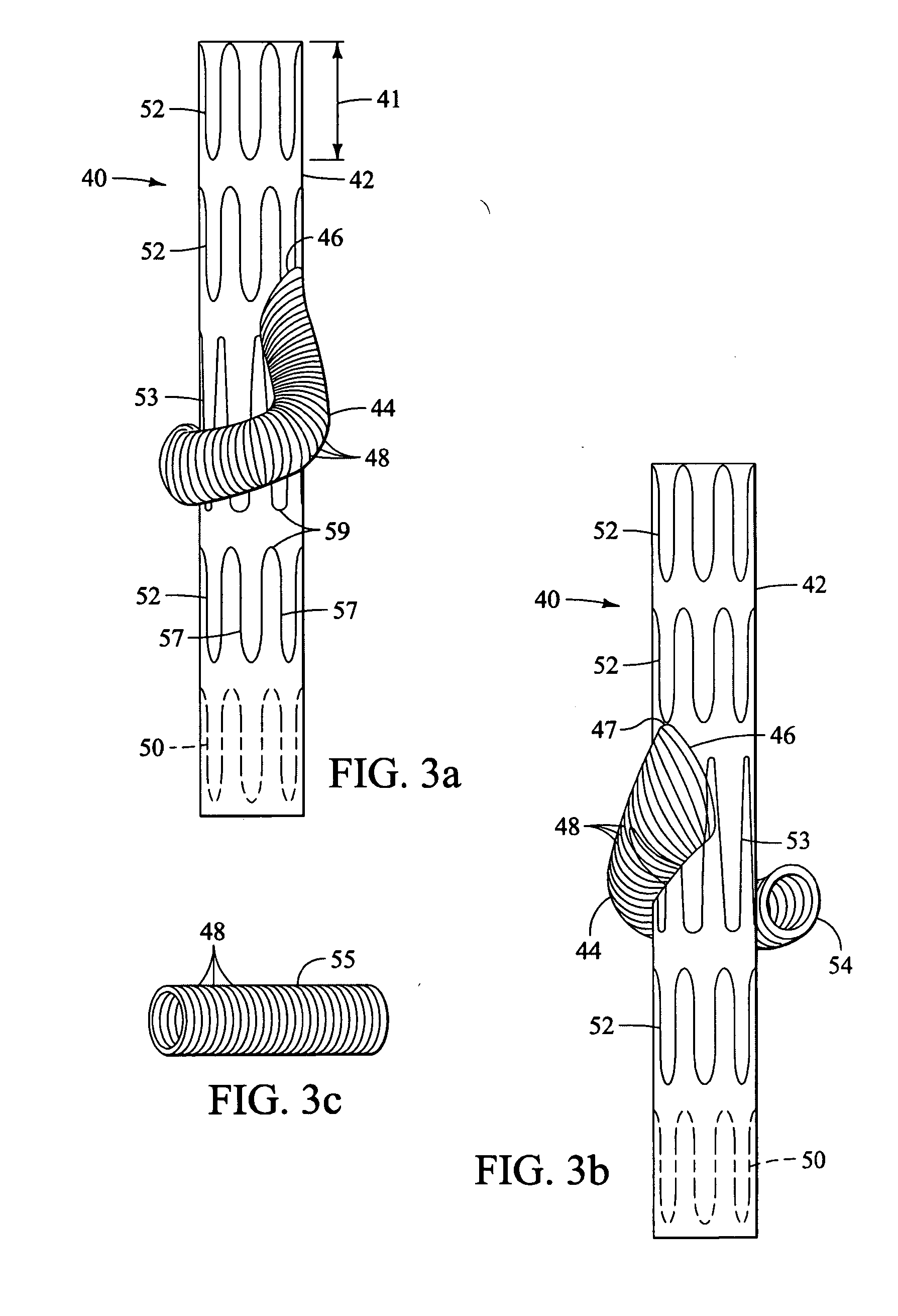 Branched vessel endoluminal device