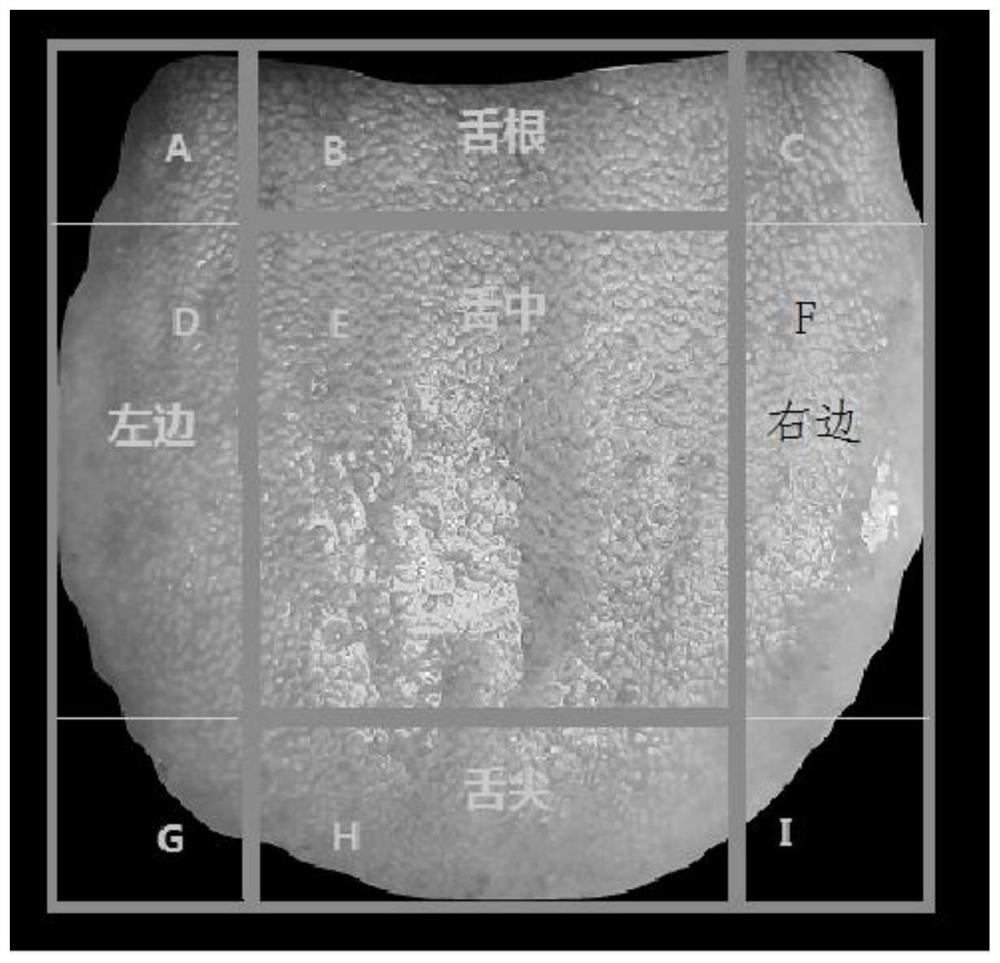 Quantitative analysis method of tongue color and fur color in traditional Chinese medicine based on machine learning