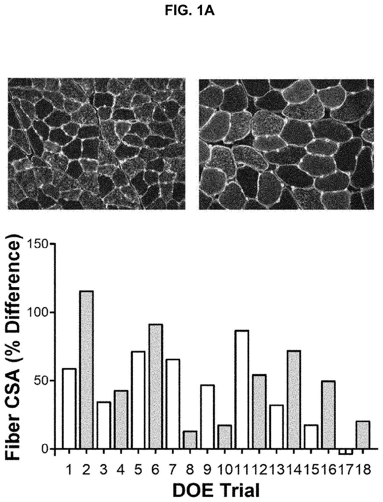 Nutrients to enhance load-induced muscle hypertrophy