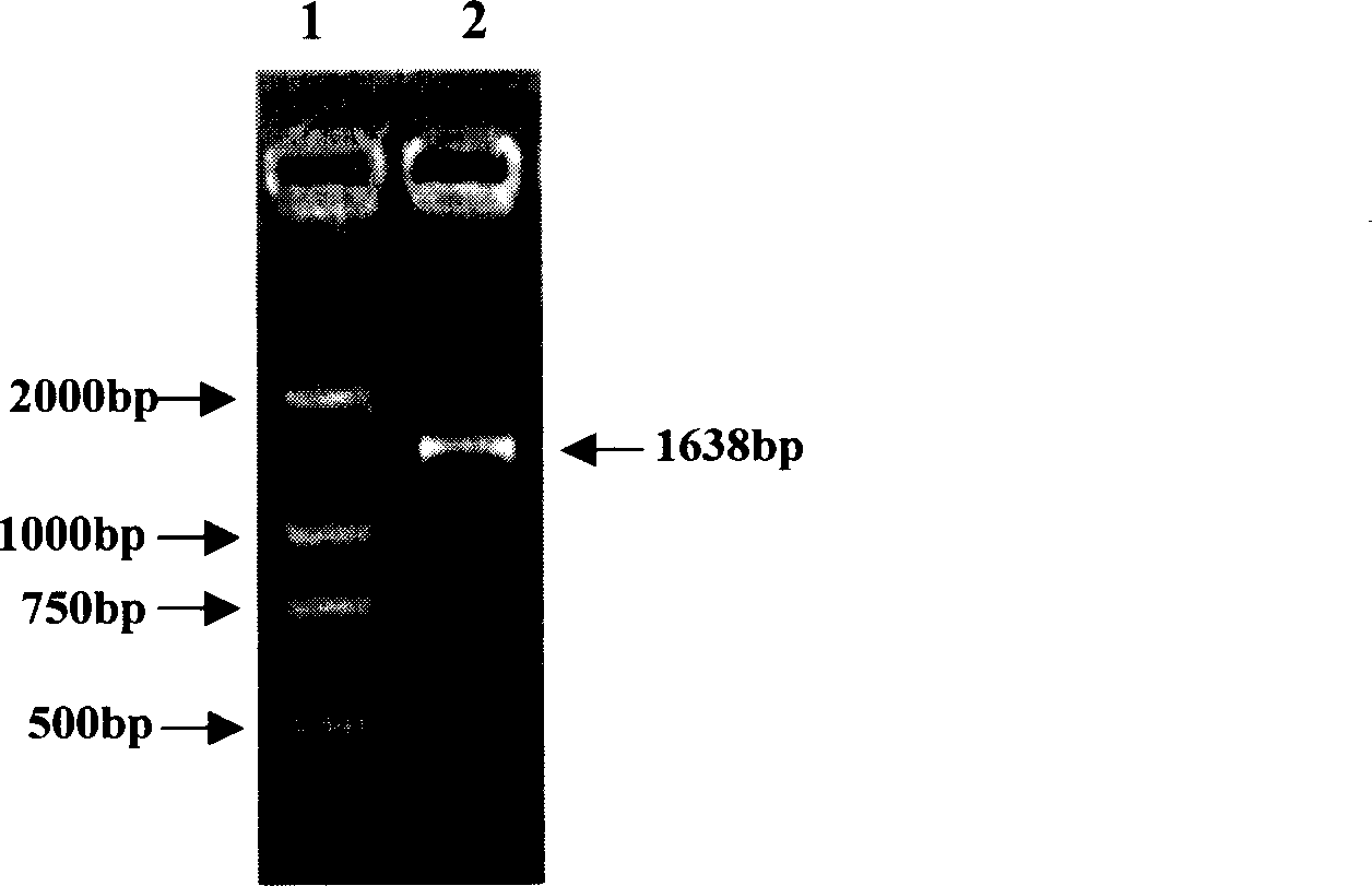 Heat shock protein 65- multiple epitope hepatitis B virus core antigen recombinant protein (HSP65-HBcAg)