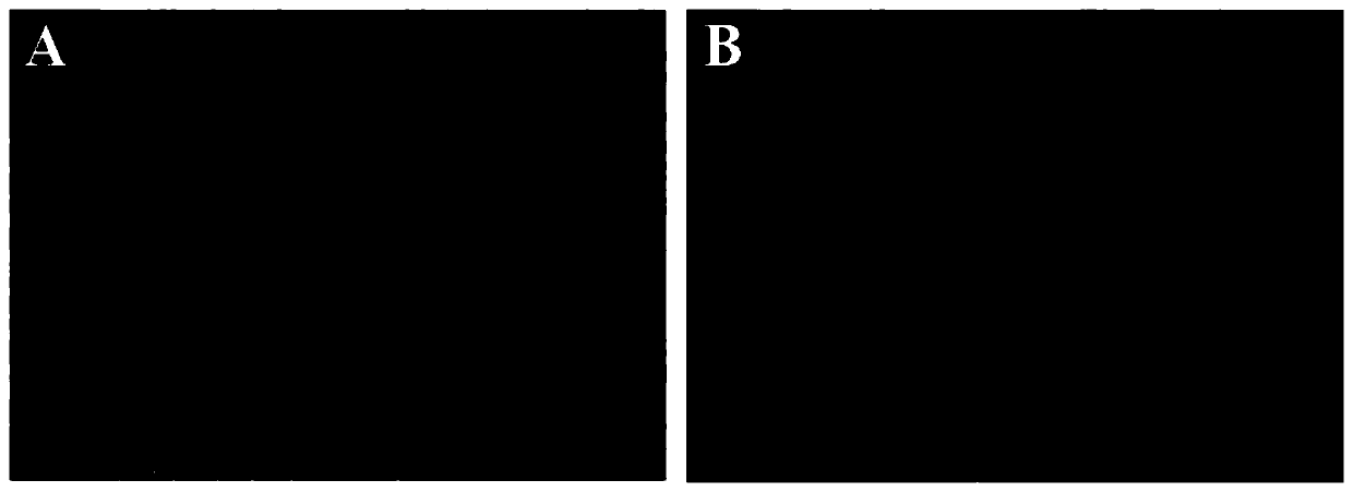 Dual-mode separation type immunosensor based on enzyme-induced biological etching and preparation method thereof