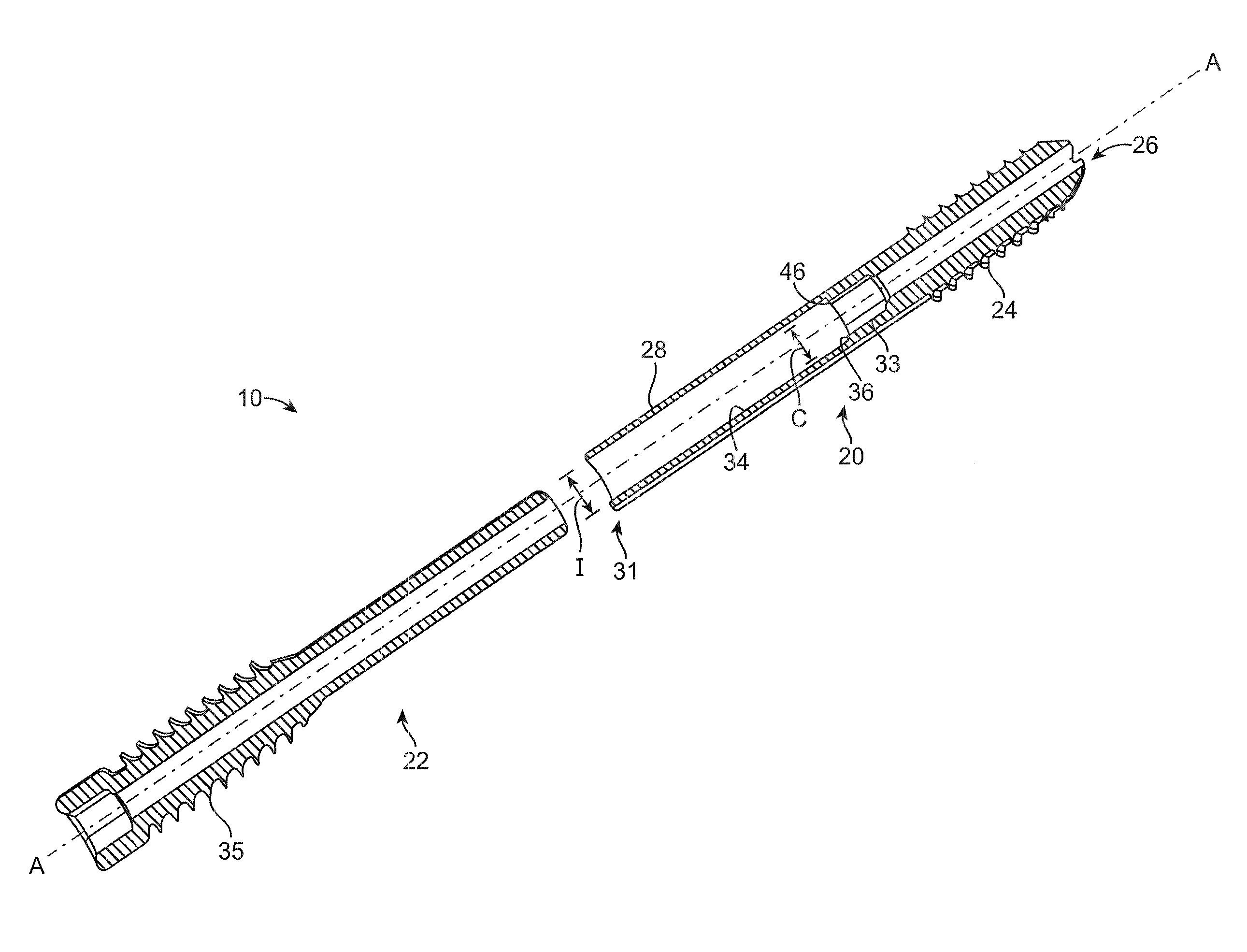 Collapsible bone screw apparatus