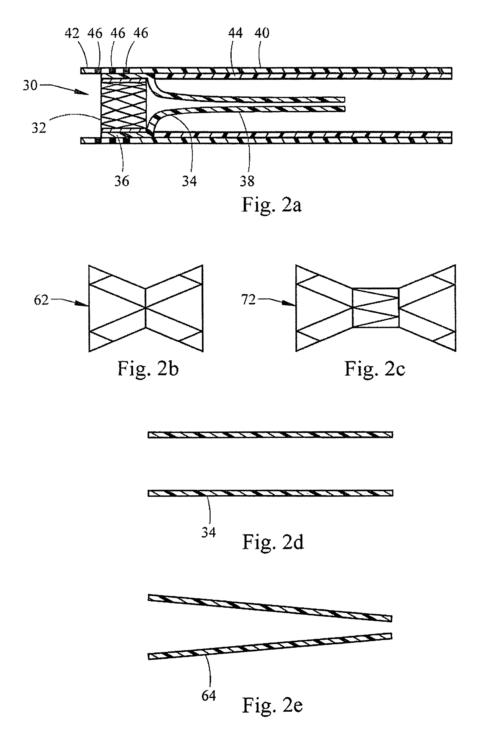 Apparatus and methods for delaying gastric emptying to treat obesity