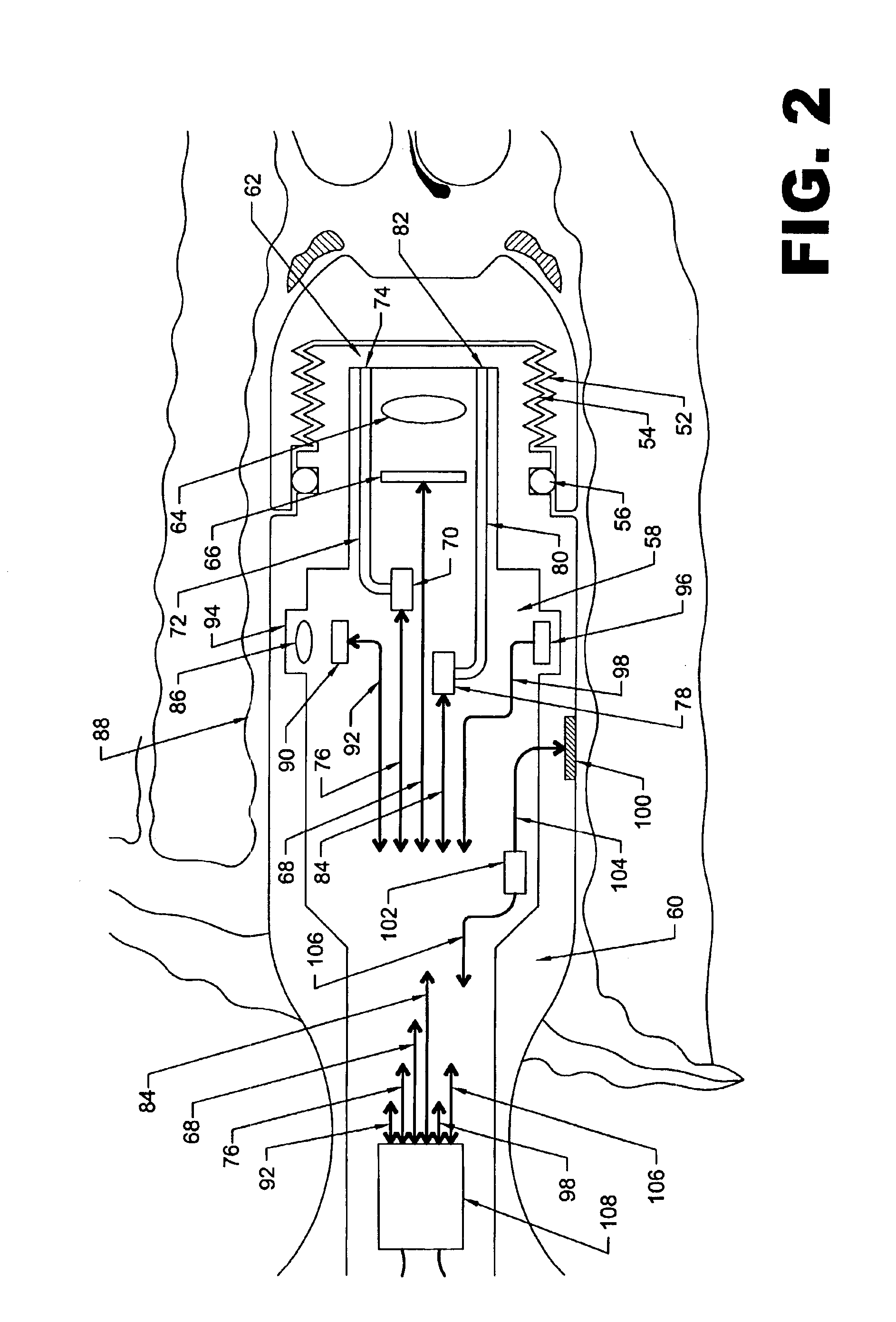 Personal pelvic viewer