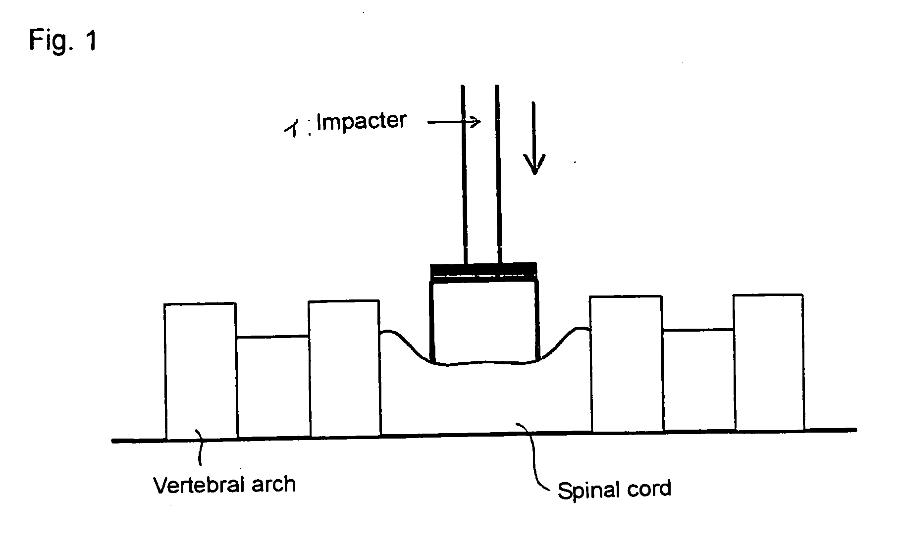 Method of constructing spinal injury model monkey and utilization thereof