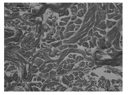 Method for preparing acellular dermal matrix by utilizing ultrasonic wave