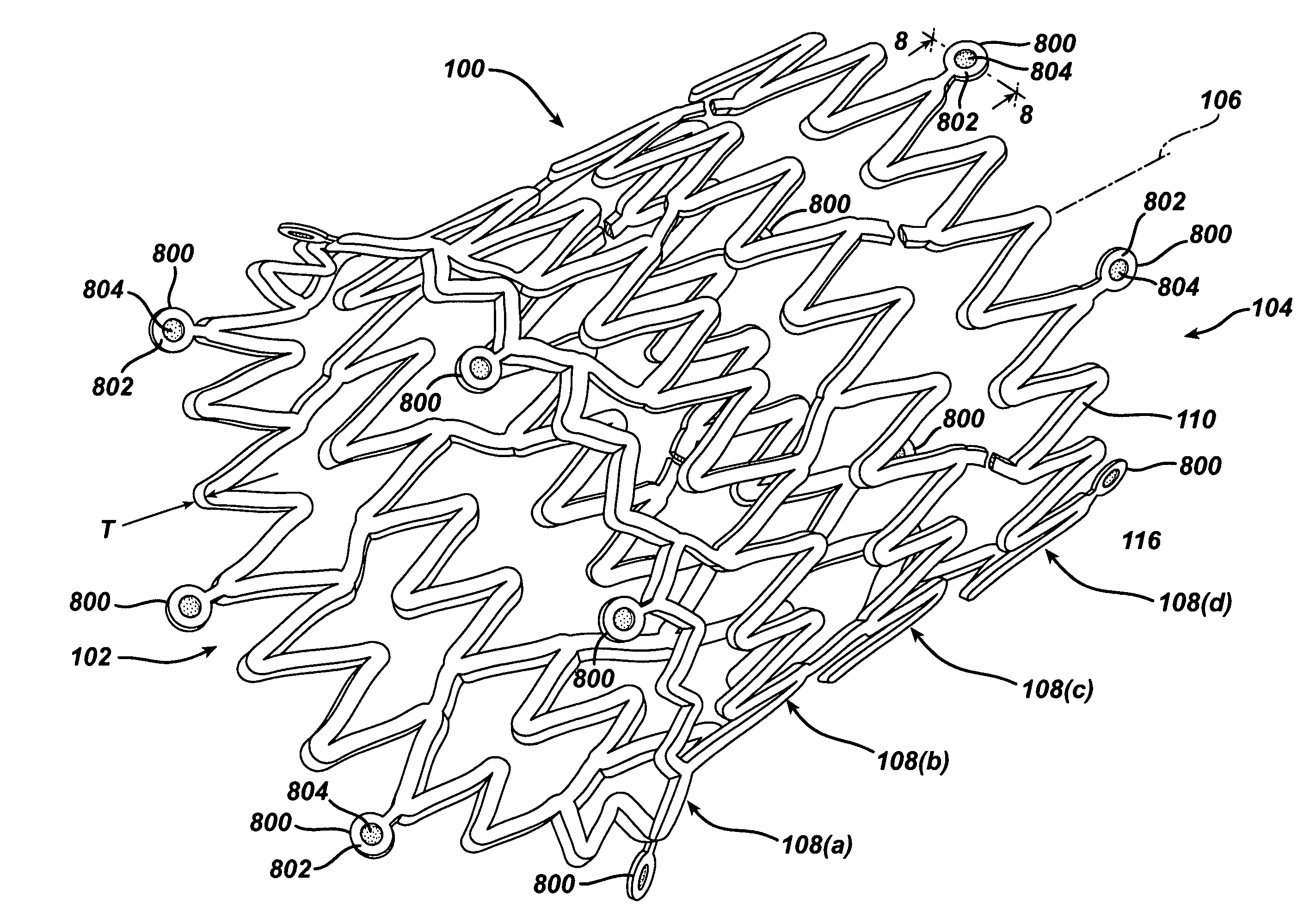 Stent design having independent stent segments which uncouple upon deployment