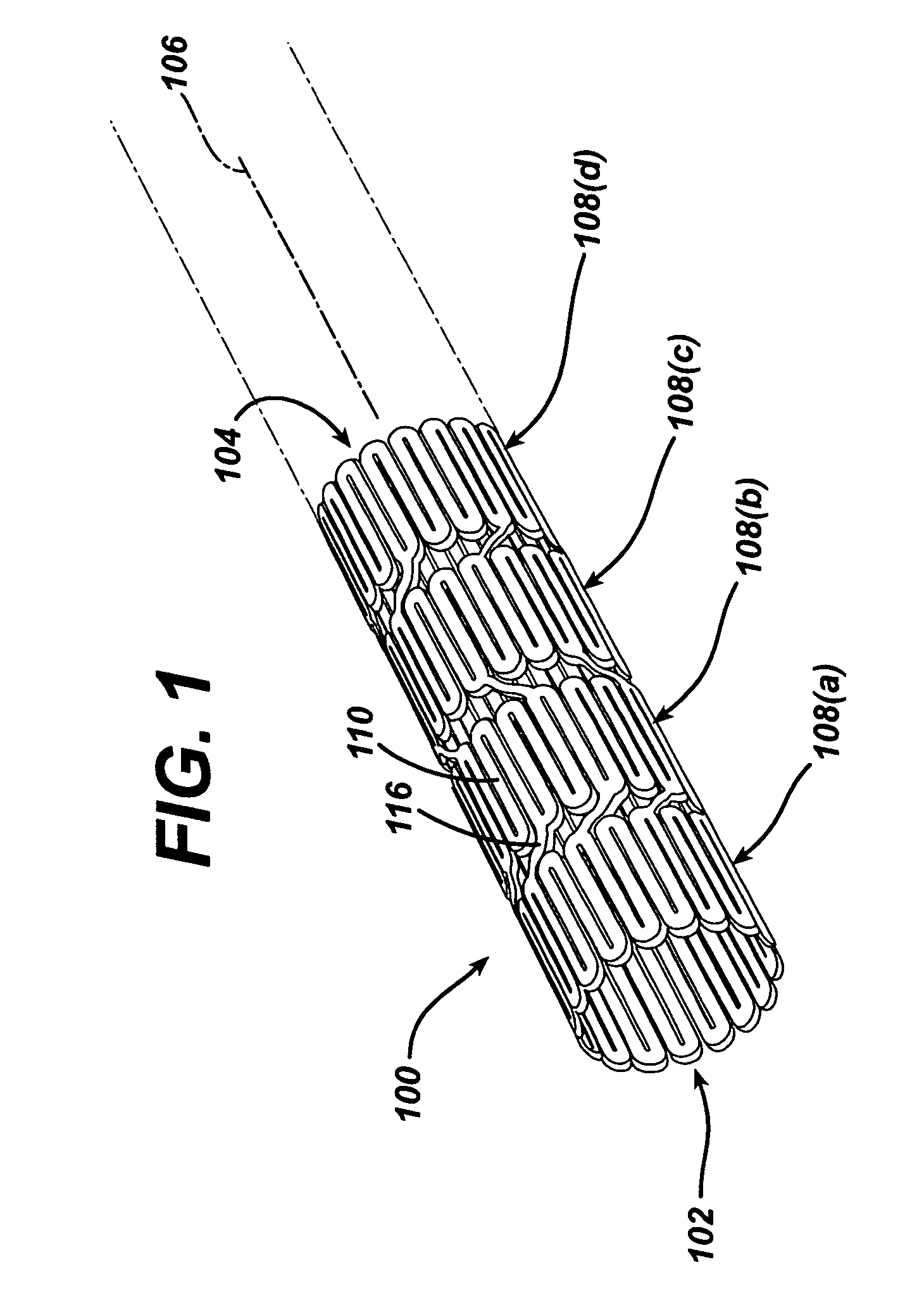 Stent design having independent stent segments which uncouple upon deployment