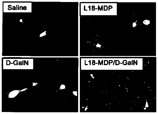 Application of phosphorylated muramyl dipeptide for preparing medicine capable of constructing fulminant liver injury animal model