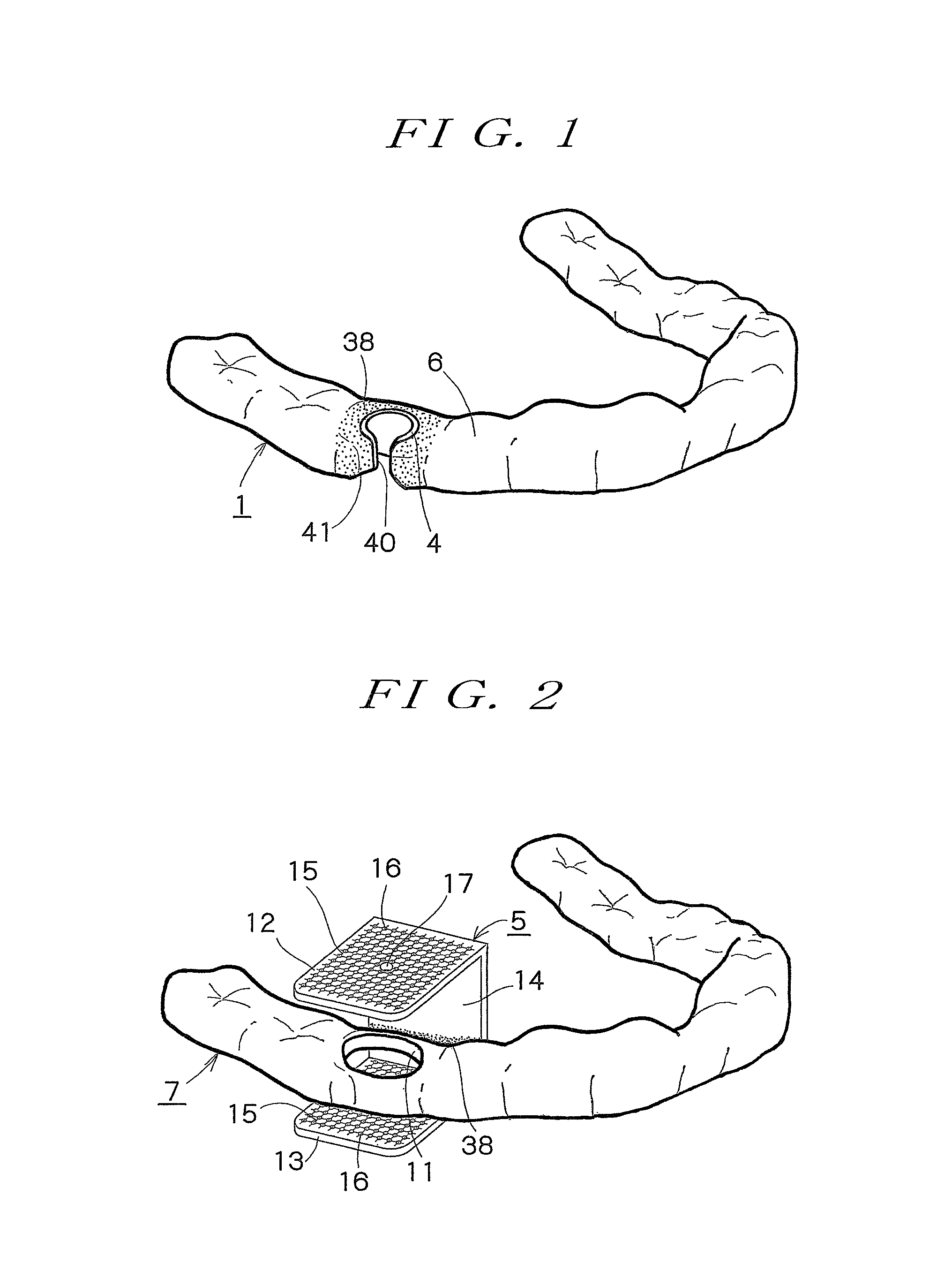 Surgical guide preparation tool and method for preparing surgical guide