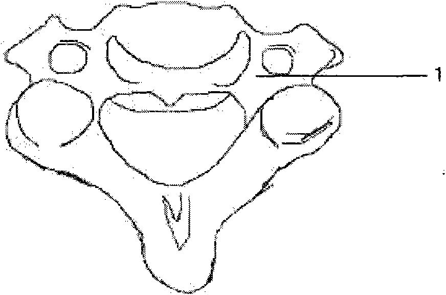 Navigation template capable of being used for positioning vertebral pedicle