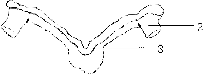 Navigation template capable of being used for positioning vertebral pedicle