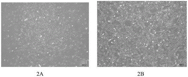 Method for separating and extracting hUC-MSC from umbilical cord outer layer amnion tissue