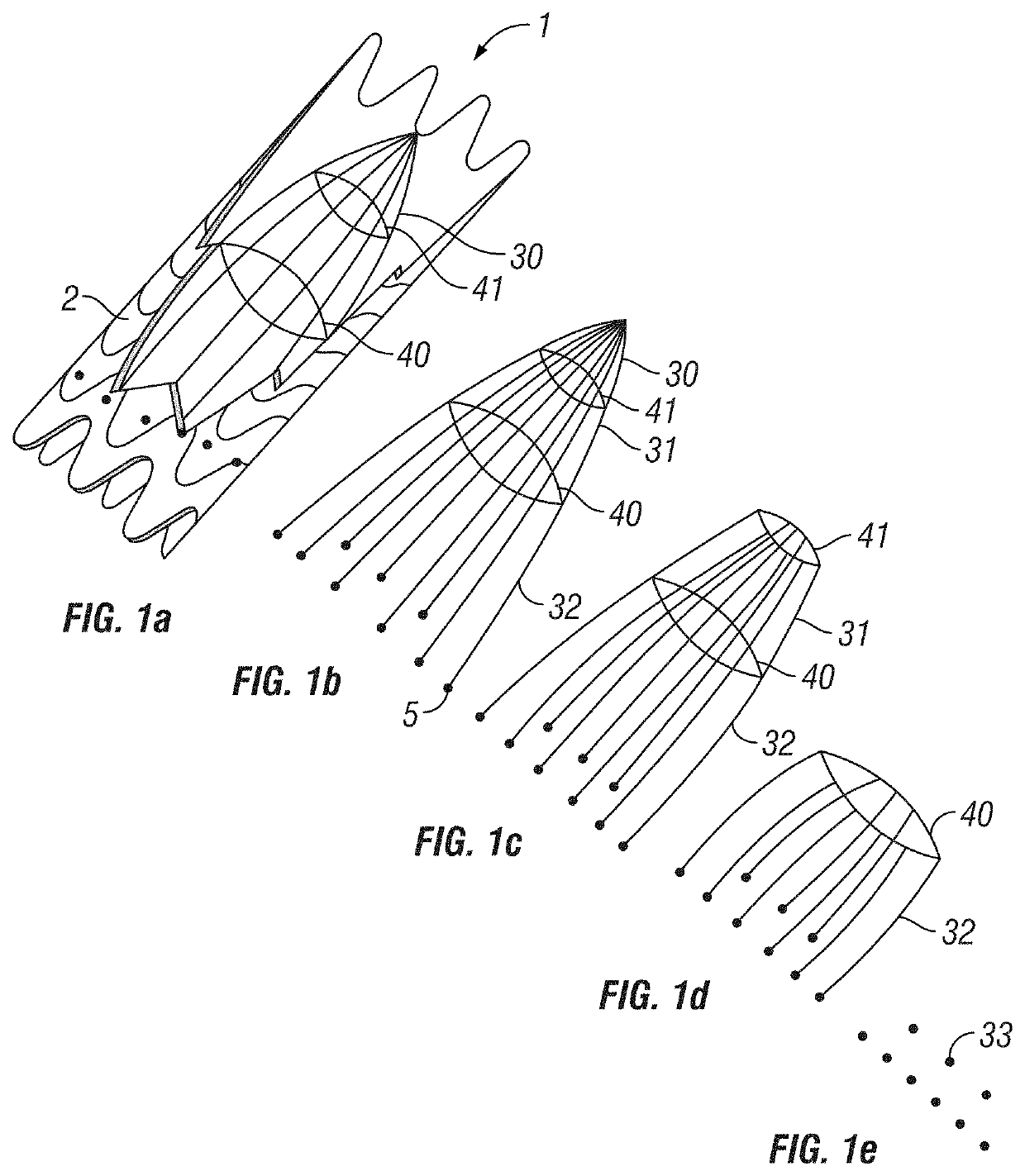 Absorbable vascular filter