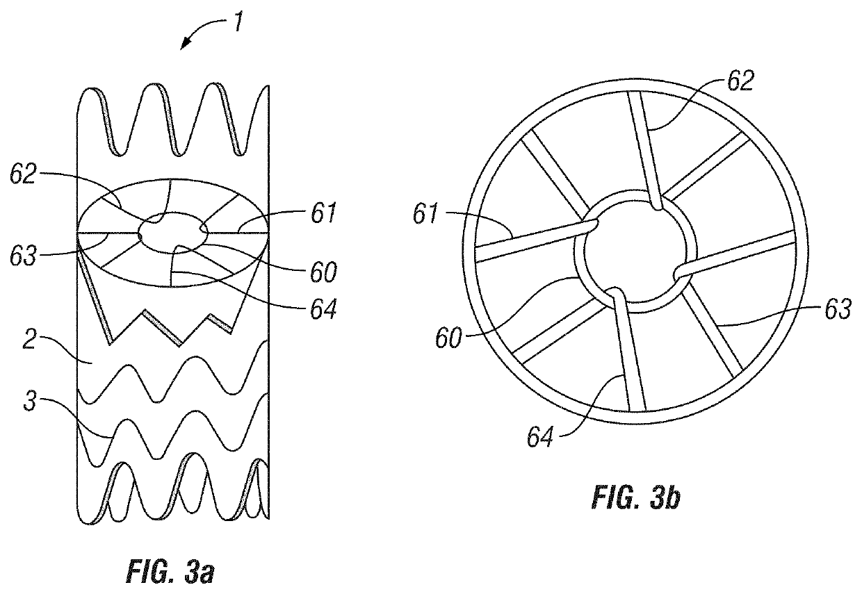 Absorbable vascular filter