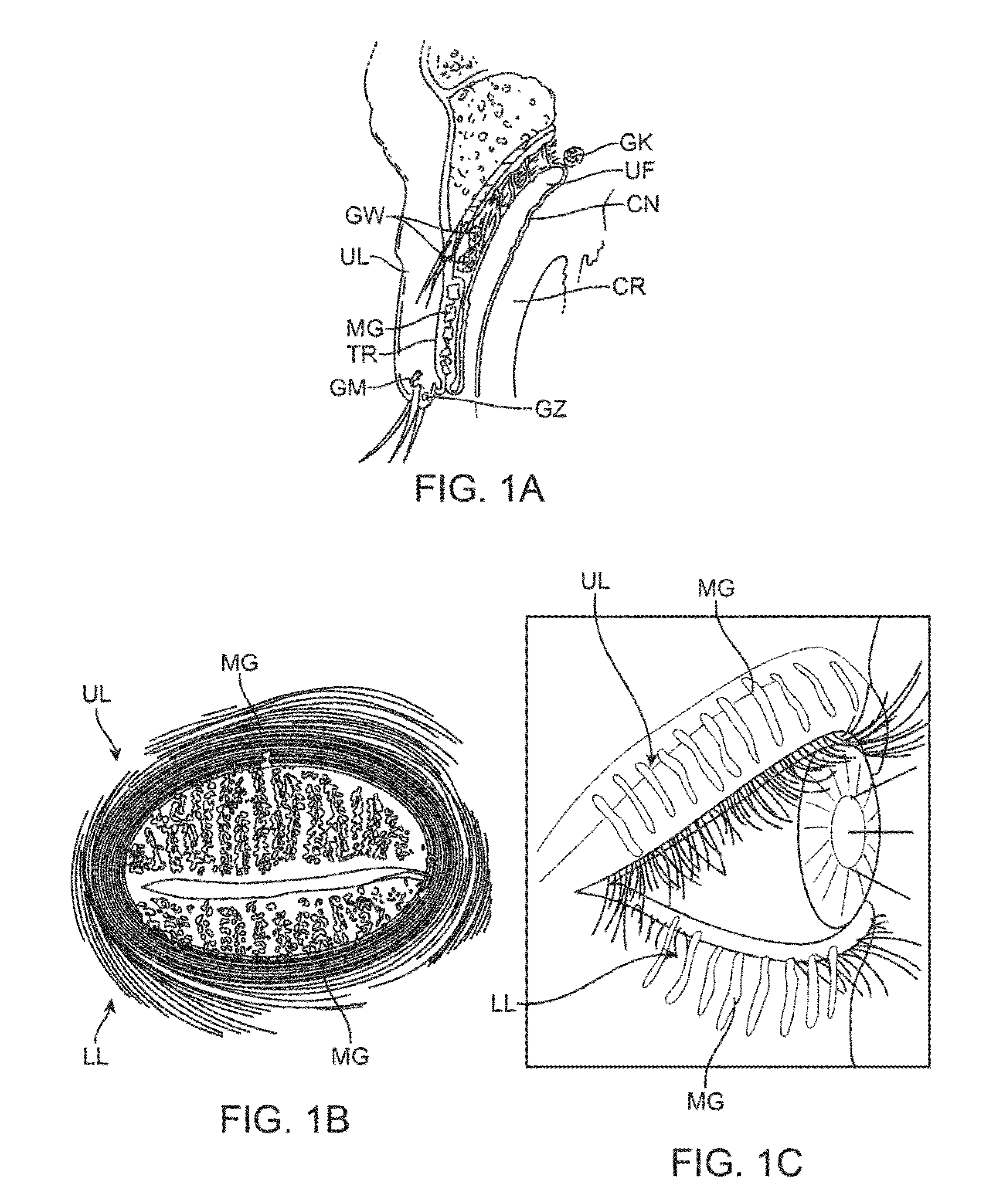 Controller for dry eye treatment systems