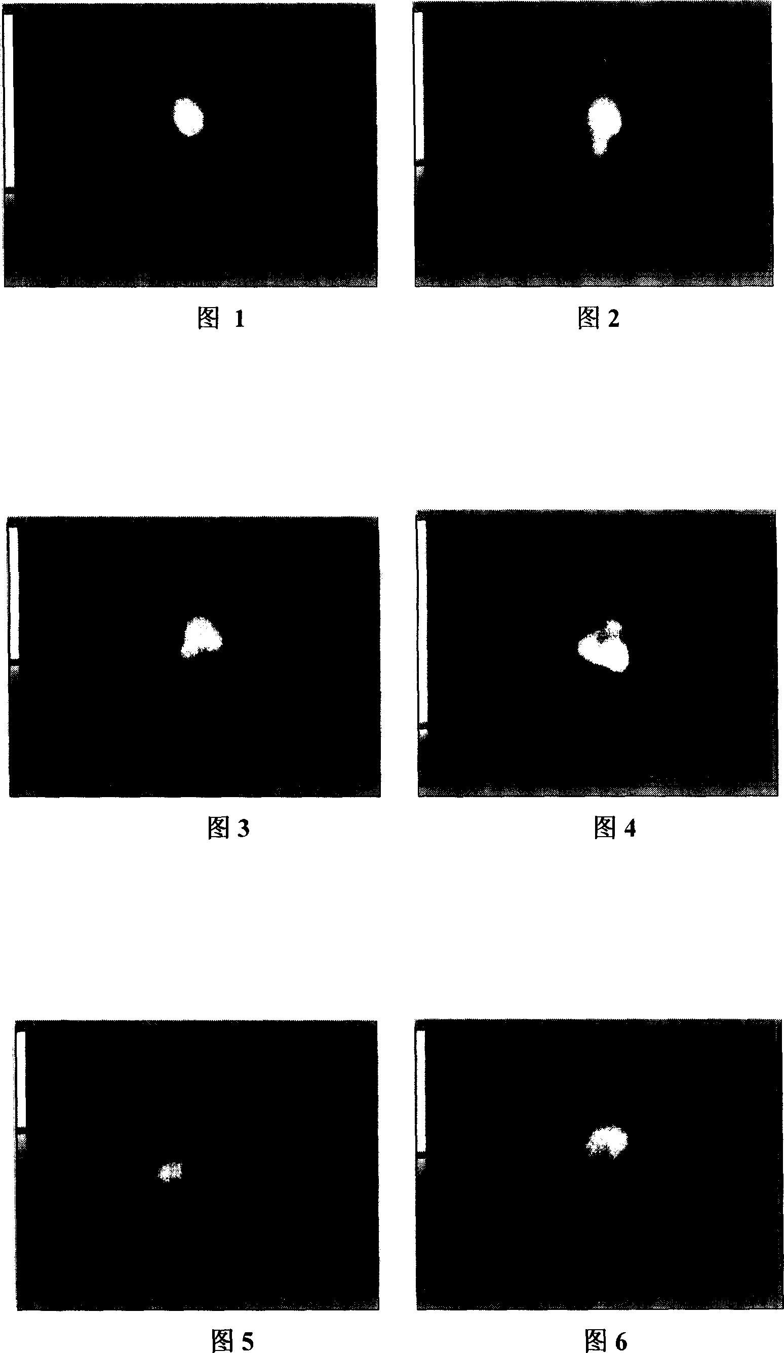 Technetium-99m signed dimercaptosuccinate complexes, preparing method and application thereof